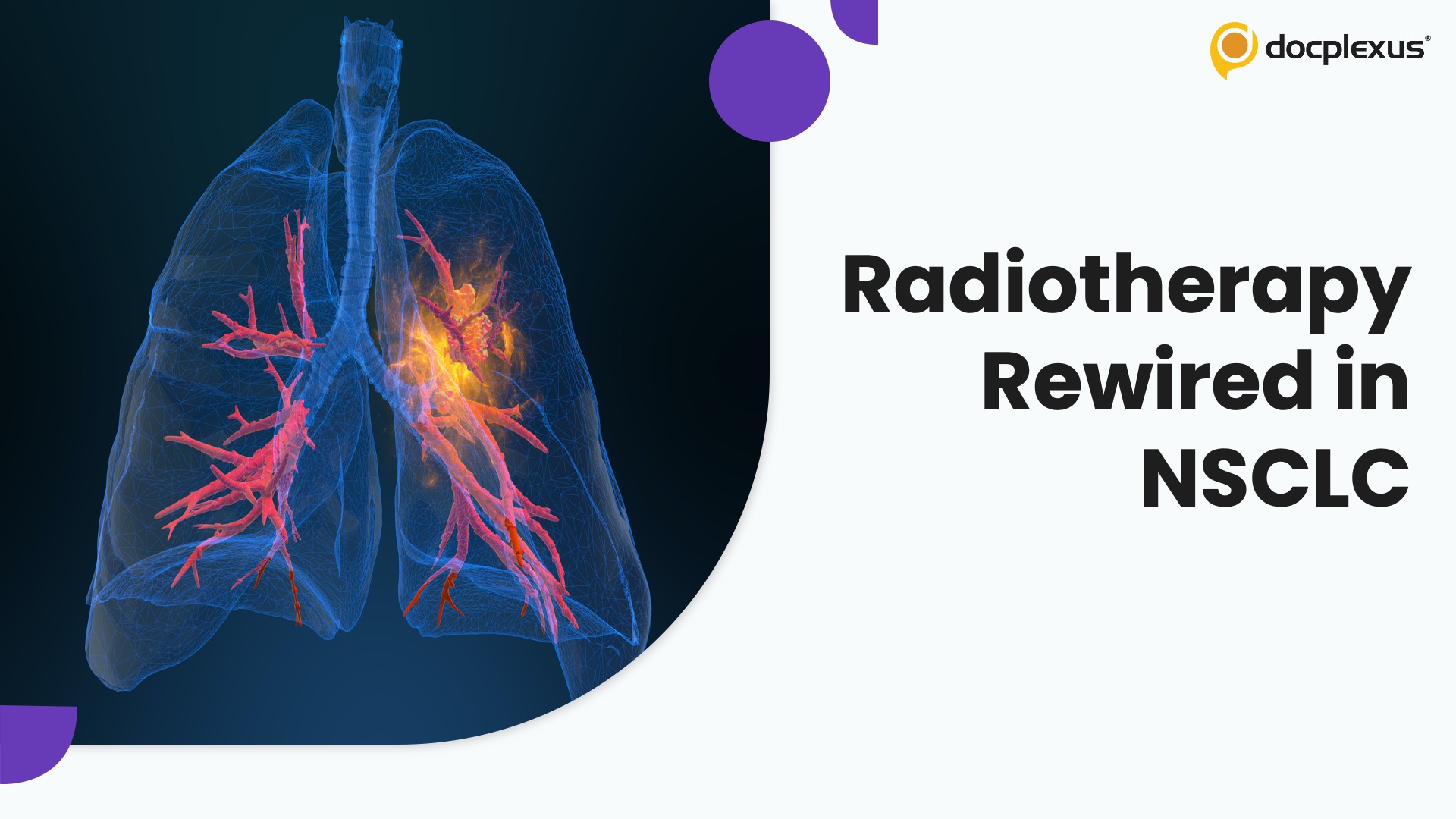 Low-Dose RT + PD‑1 Blockade Reprograms Neutrophils for Durable Survival in NSCLC