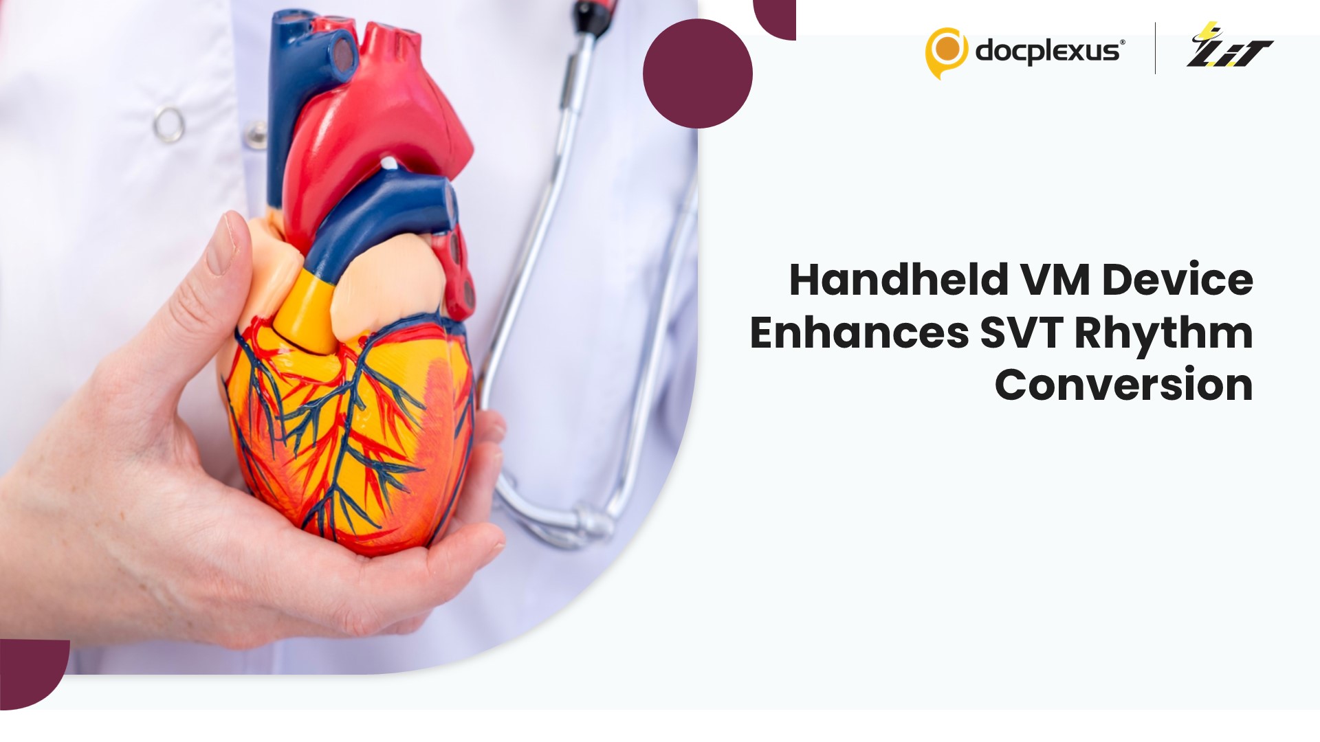 Handheld VM Assist Device Enhances Sinus Rhythm Restoration in SVT