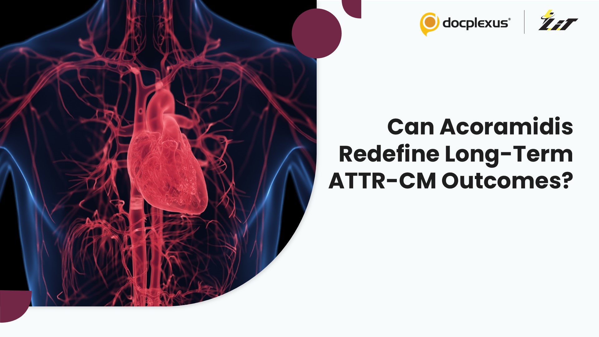 Can Early Acoramidis Therapy Change the Long-Term Outlook in ATTR-CM?