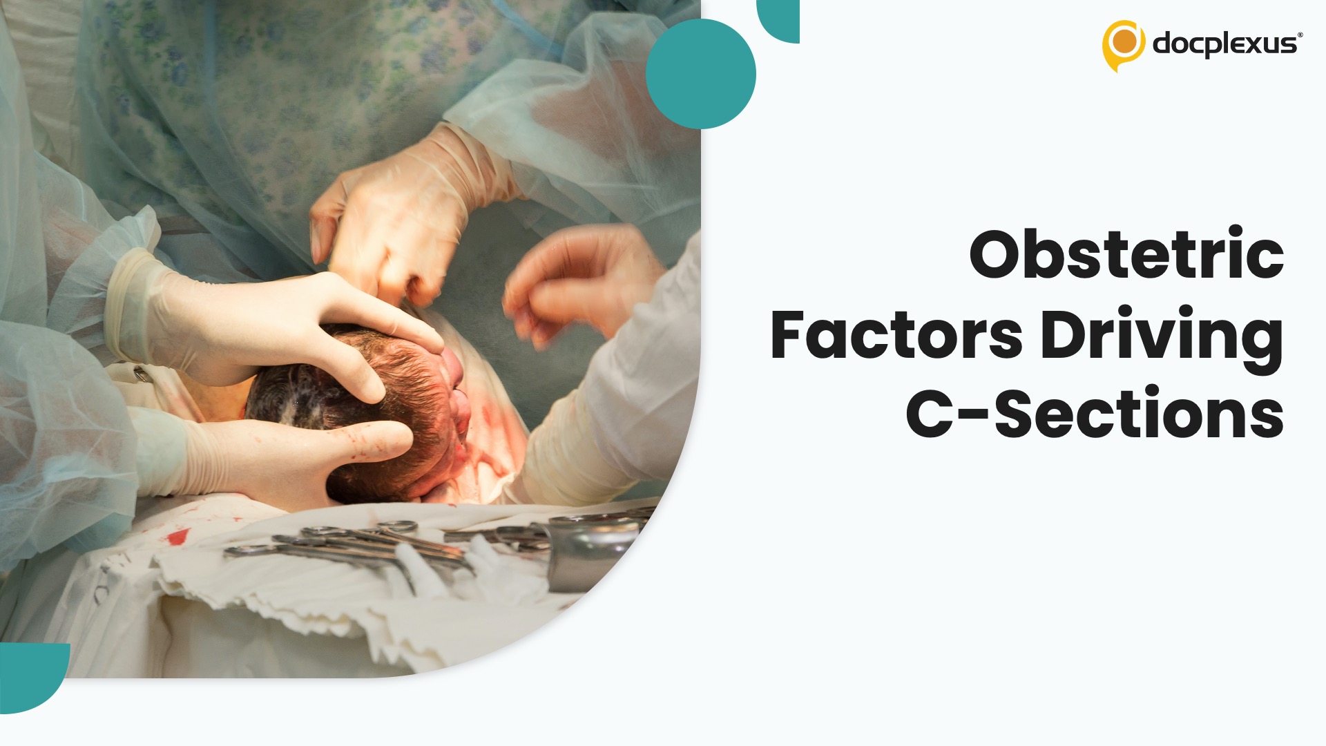 Cesarean Section Trends: Are Modifiable Obstetric Factors Driving the Rise?