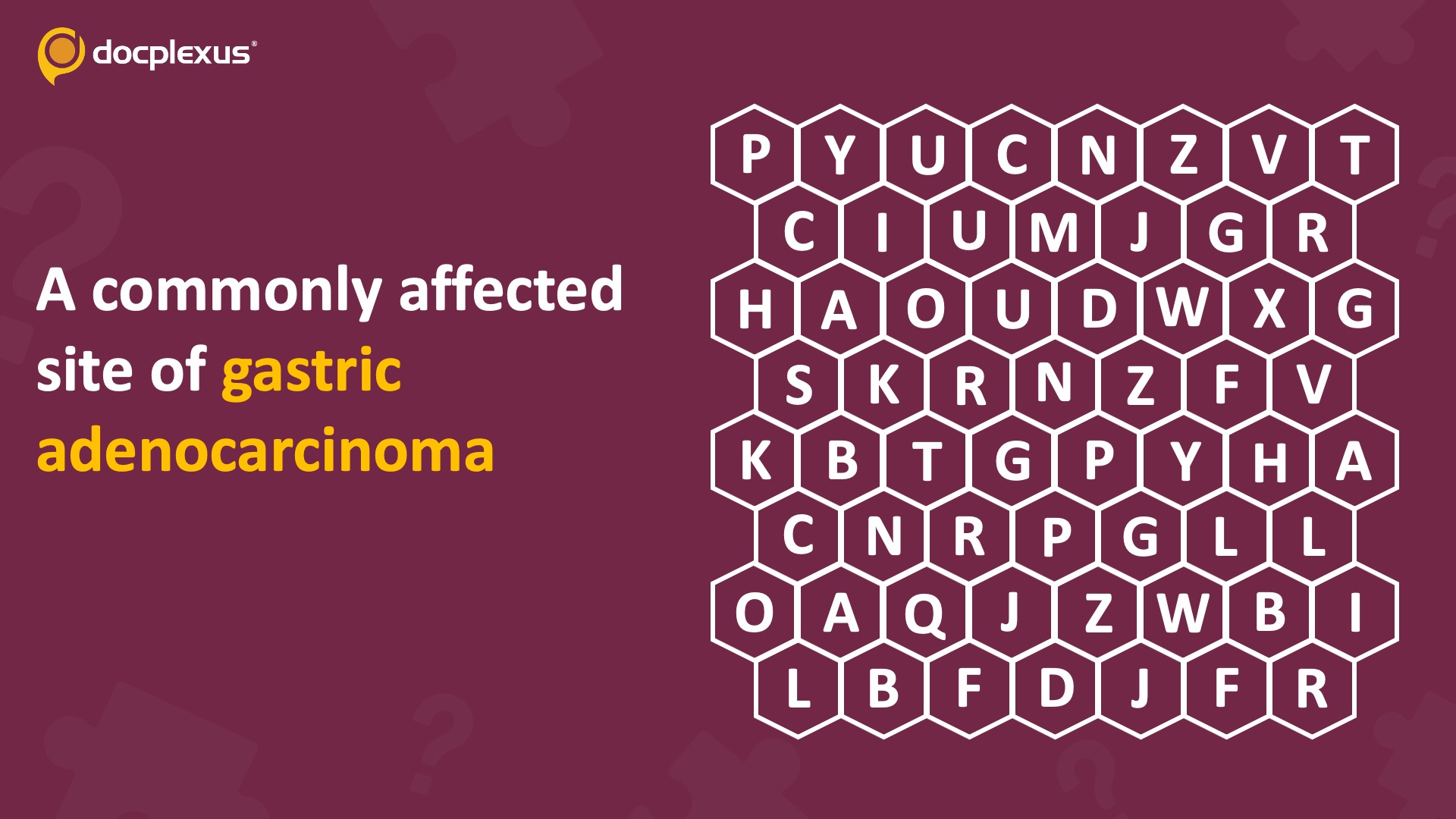 Can You Identify a Common Site of Gastric Adenocarcinoma?