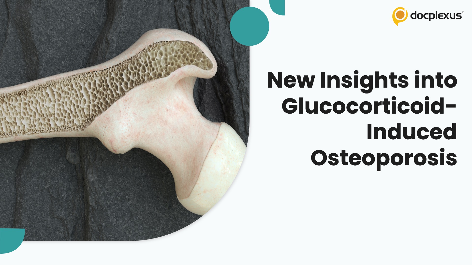 Glucocorticoids Save Lives - but silently affect bone architecture : Rethinking Prevention of Steroid-Induced Fractures
