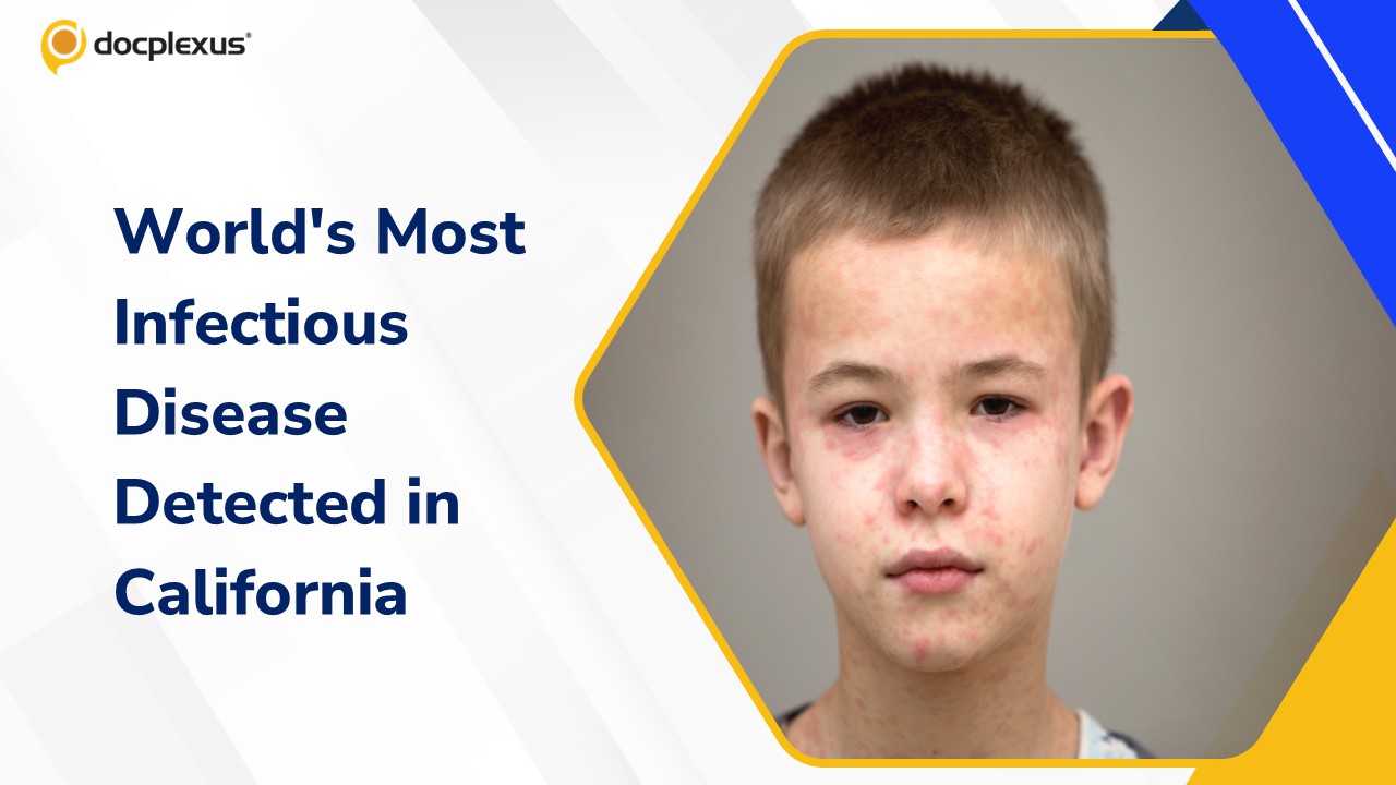 California Issues Measles Exposure Alert After Infected Traveler Passed Through Major Transit Hubs