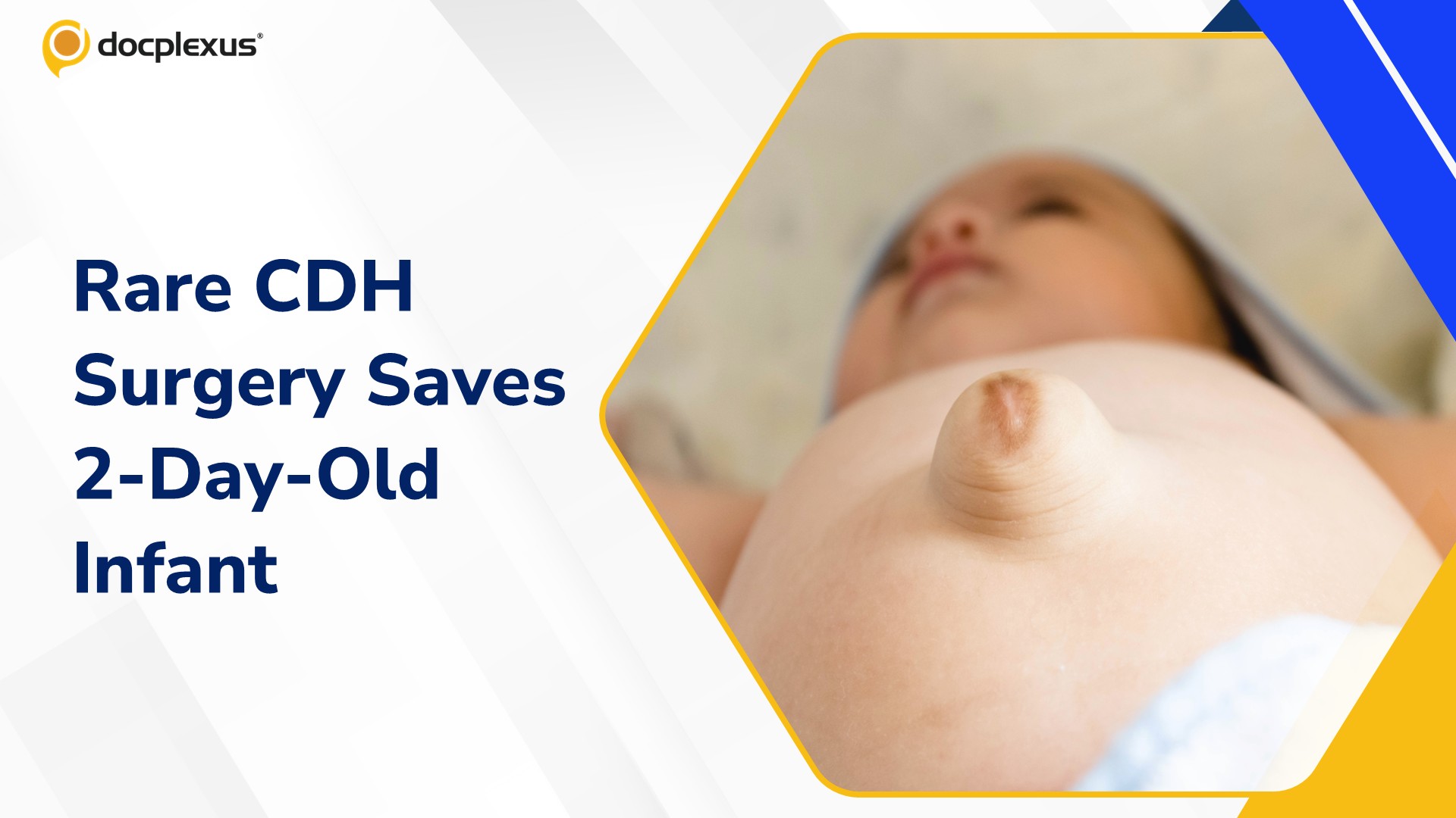 Tripura Doctors Save Two-Day-Old Newborn with Rare Congenital Diaphragmatic Hernia Surgery