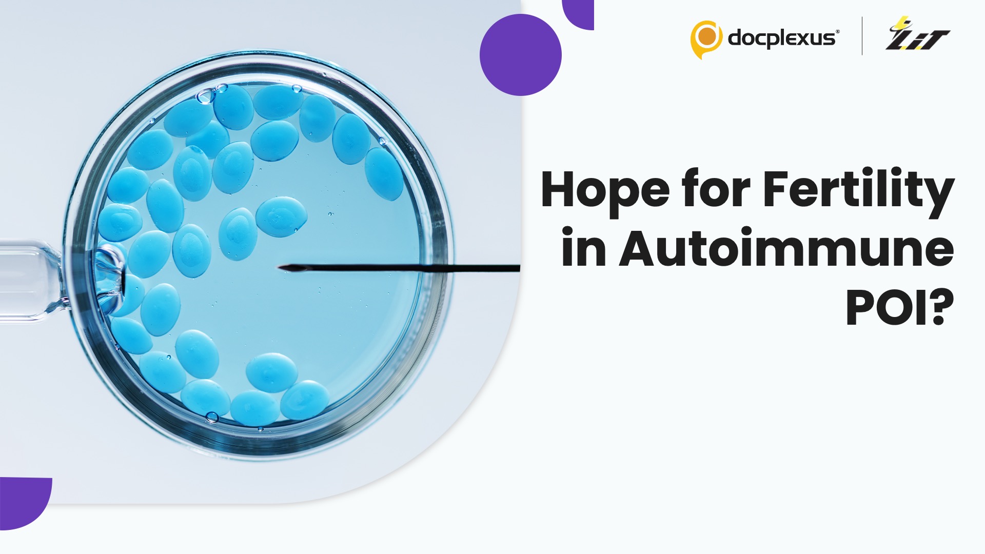 Can Rituximab Restore Fertility in Autoimmune Premature Ovarian Insufficiency?