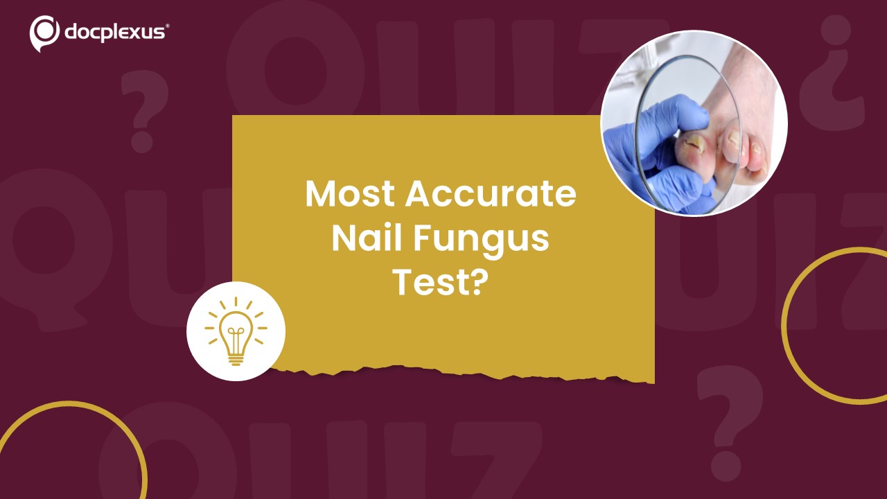 Which Test Best Confirms Onychomycosis Today?