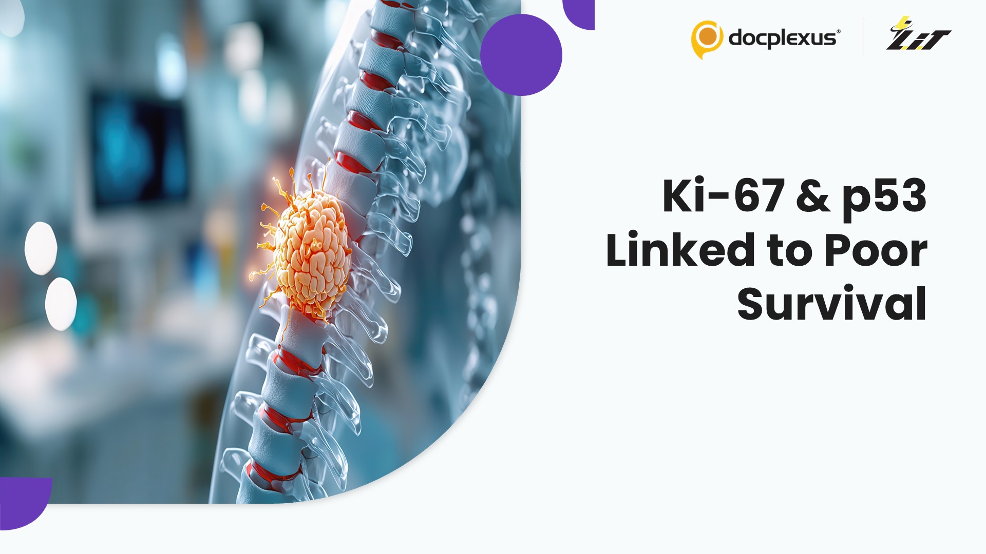 Key Prognostic Markers in Pediatric Spinal Tumors