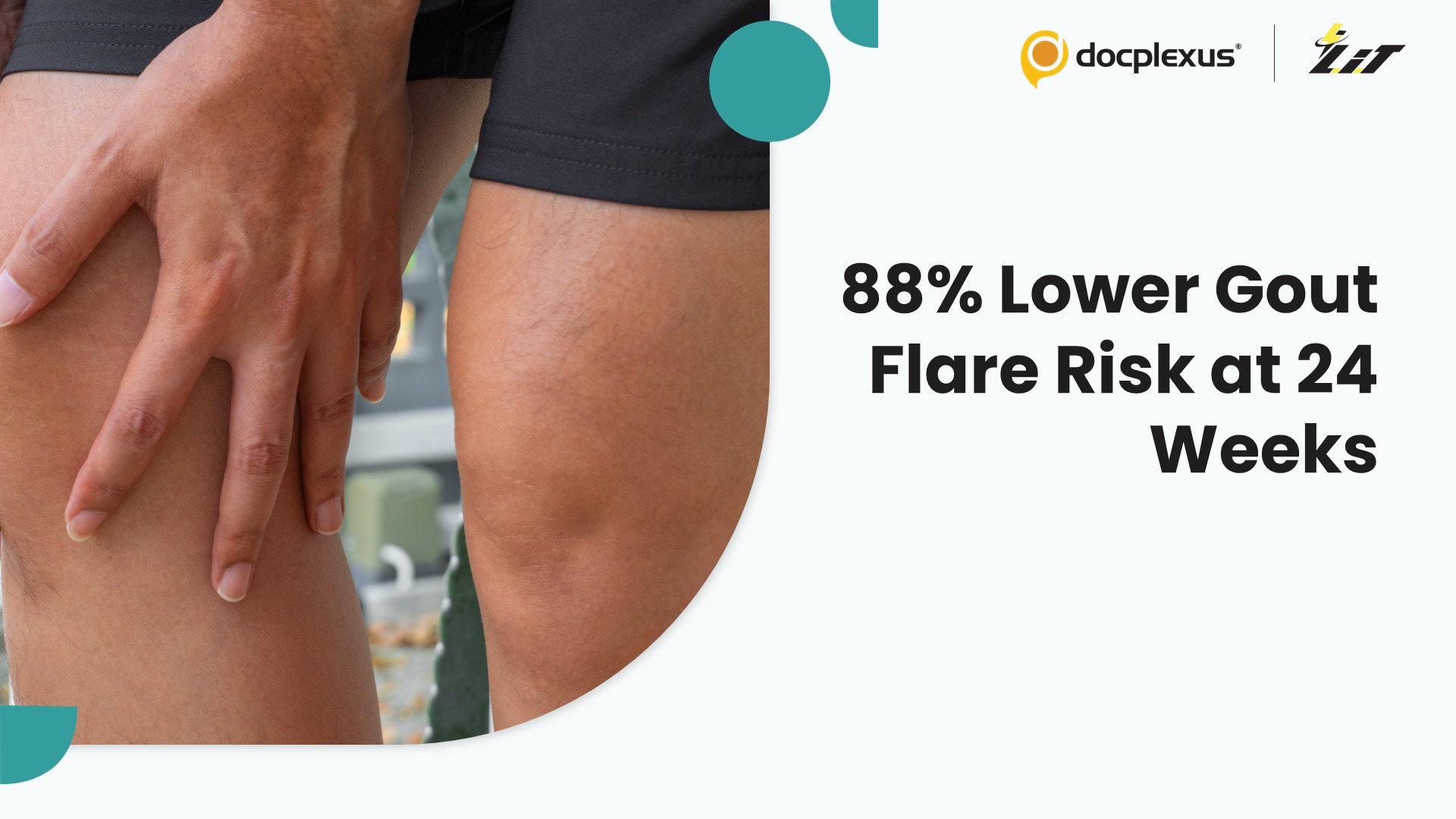 Firsekibart Demonstrates Superior Flare Prevention in Patients with Frequent Gout Attacks