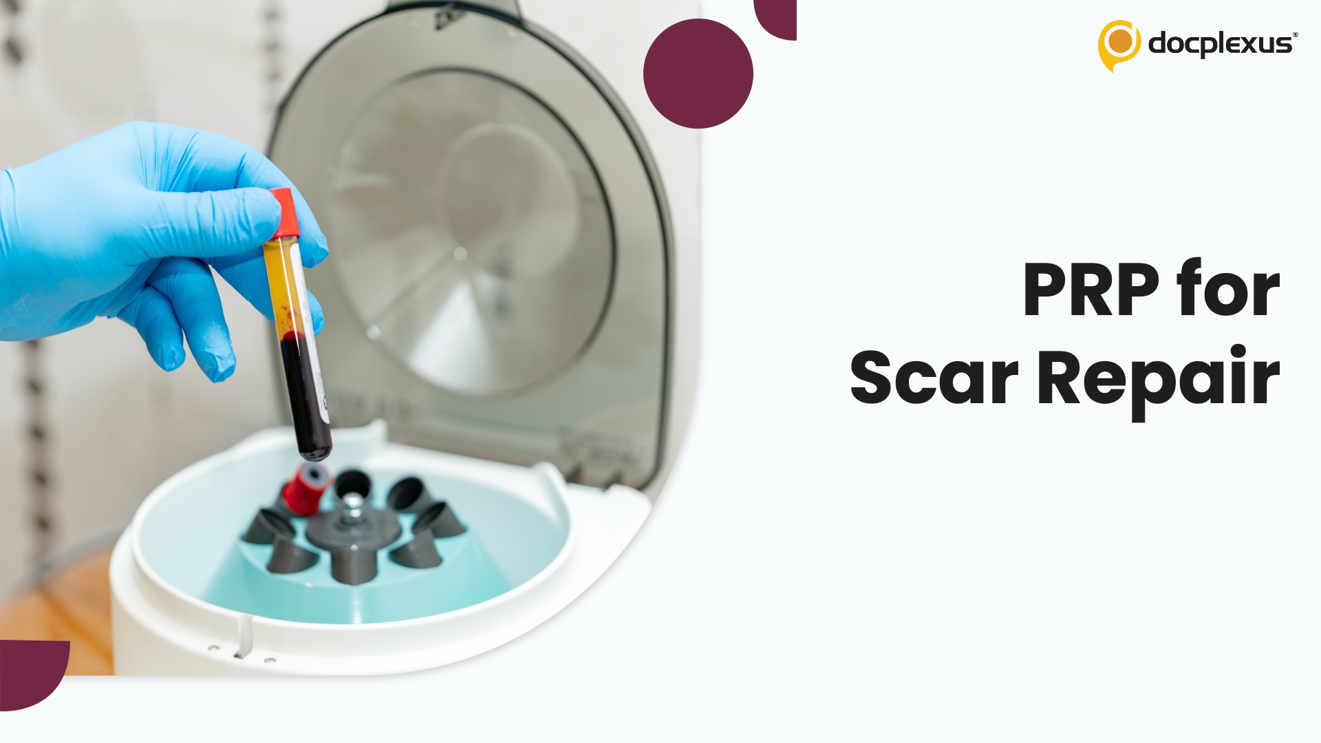 Beyond Silicone: Platelet-Rich Plasma Shows Superior Scar Remodeling in Clinical Trial