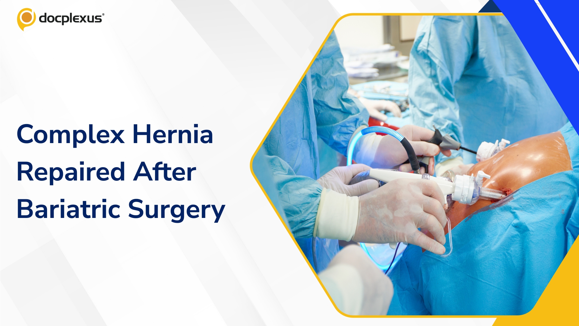 Staged Bariatric Approach Enables Successful Repair of Complex Loss of Domain Ventral Hernia