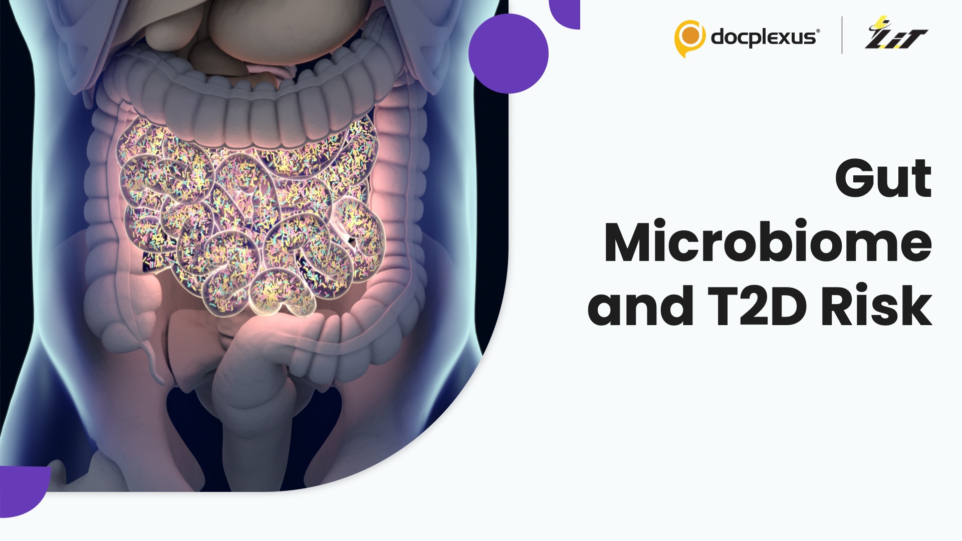 Gut Microbiome Signatures May Predict Future Type 2 Diabetes Risk