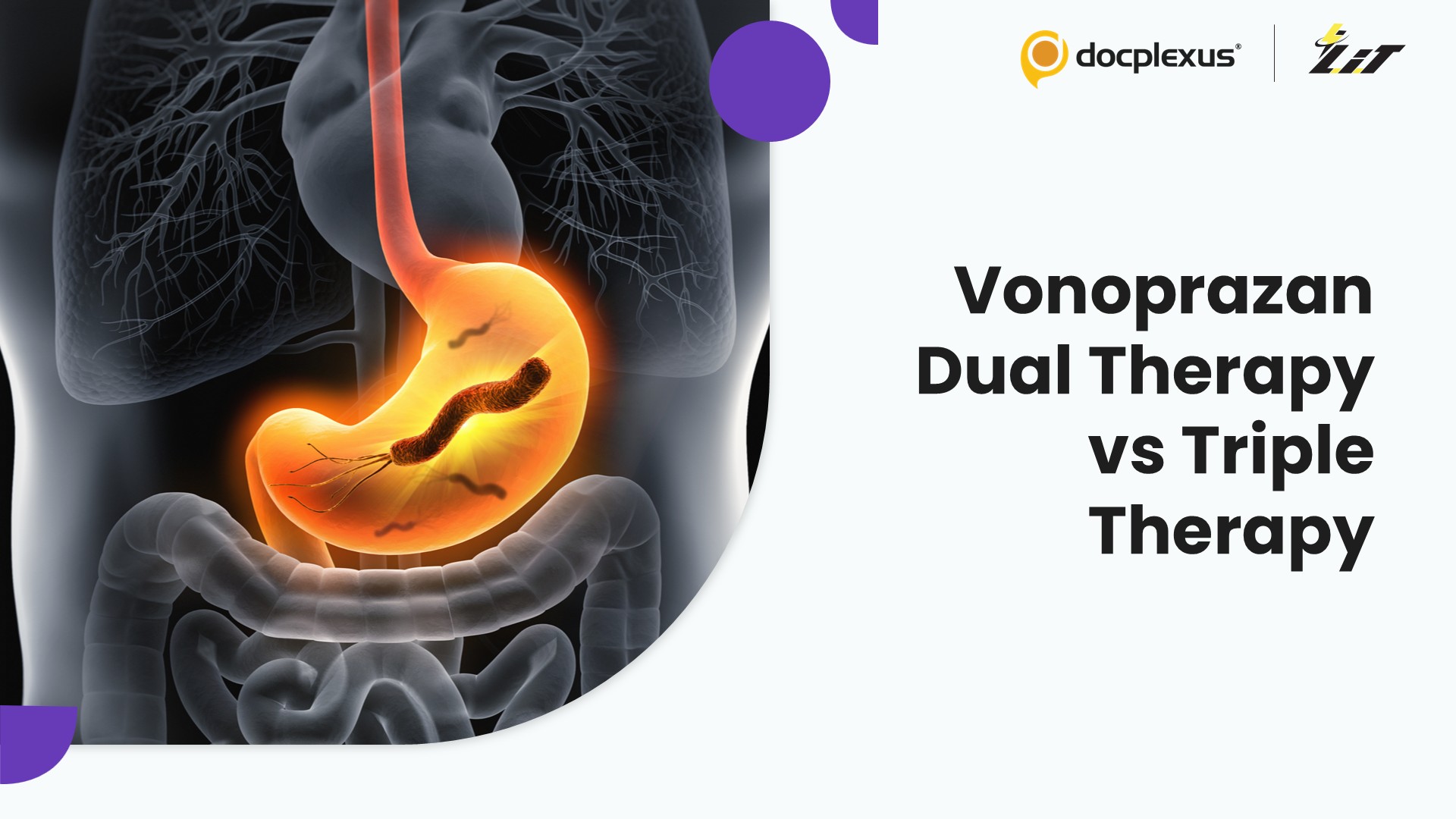 Vonoprazan-Based Dual Therapy Shows Favorable Real-World Outcomes for Helicobacter pylori Eradication