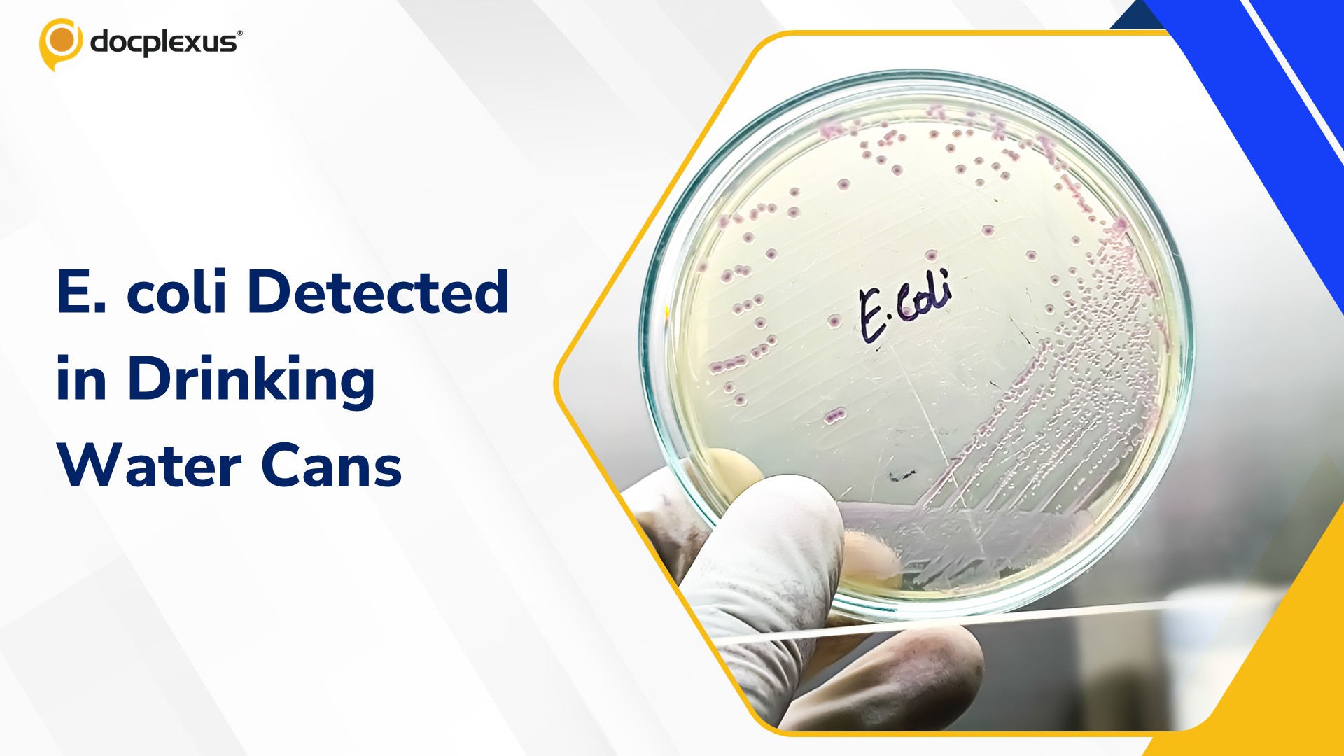 E. coli-Contaminated Drinking Water Triggers Vomiting and Diarrhoea Outbreak in Karnataka Village