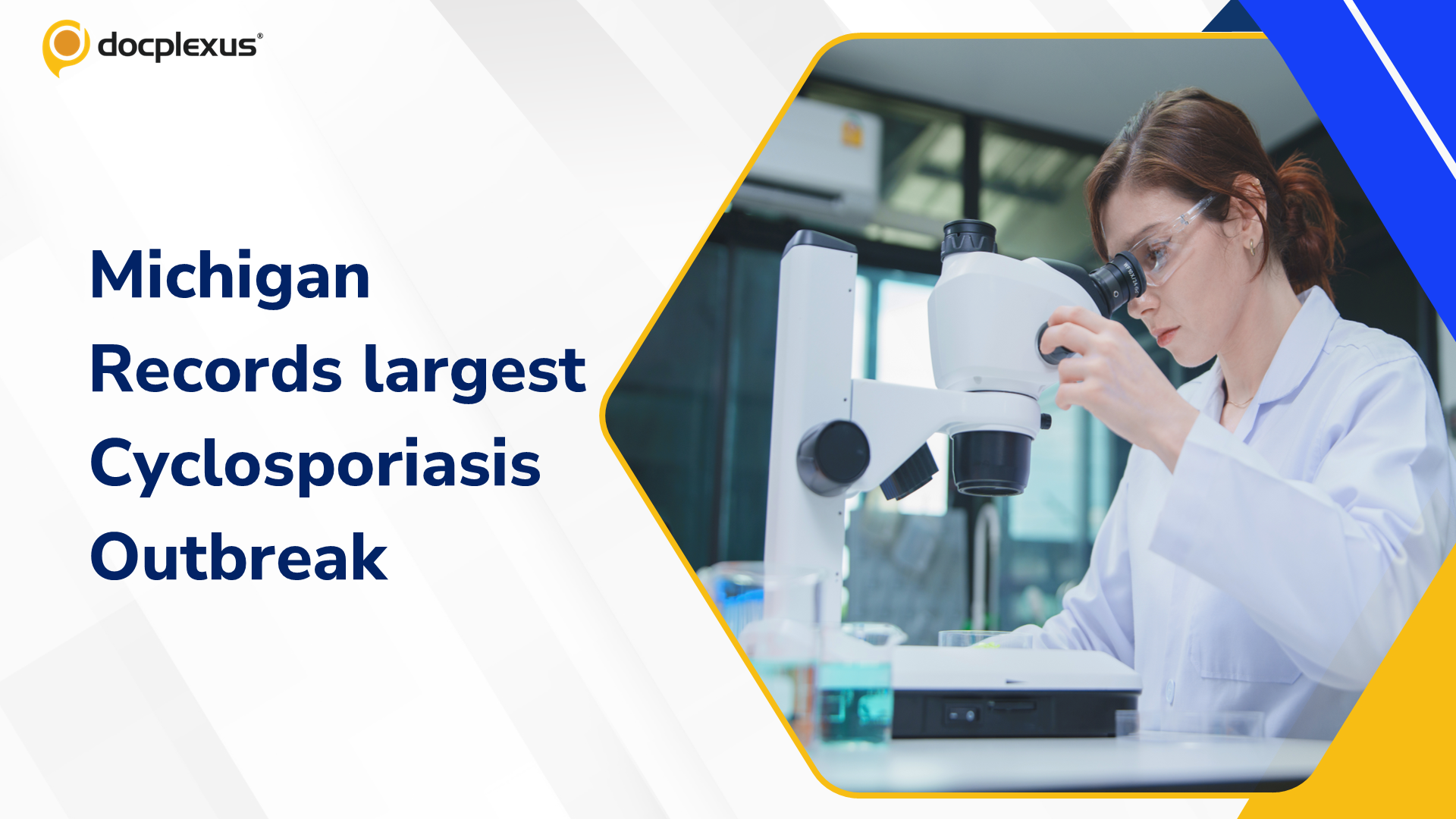 Michigan Reports Nearly 1,000 Cyclosporiasis Cases in Largest-Ever Outbreak