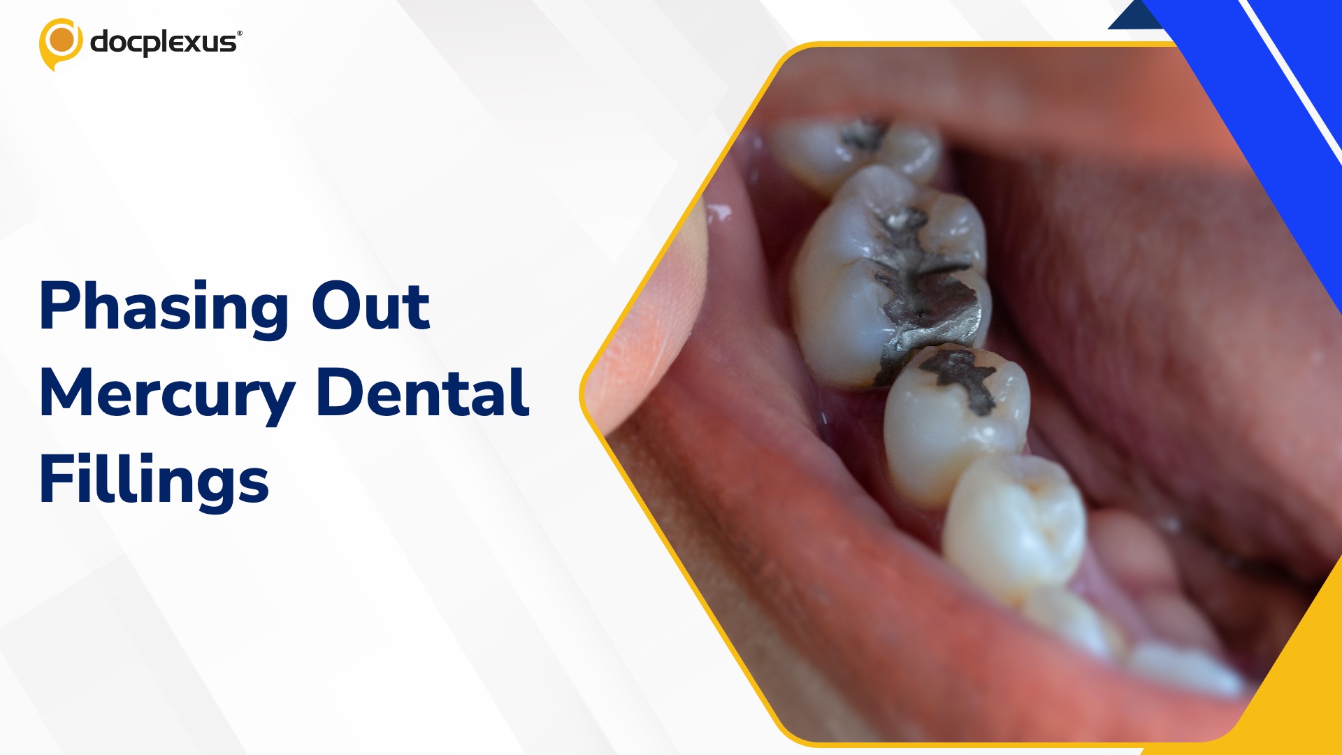 WHO Calls for Phasing Out Mercury Dental Fillings in SEA Region