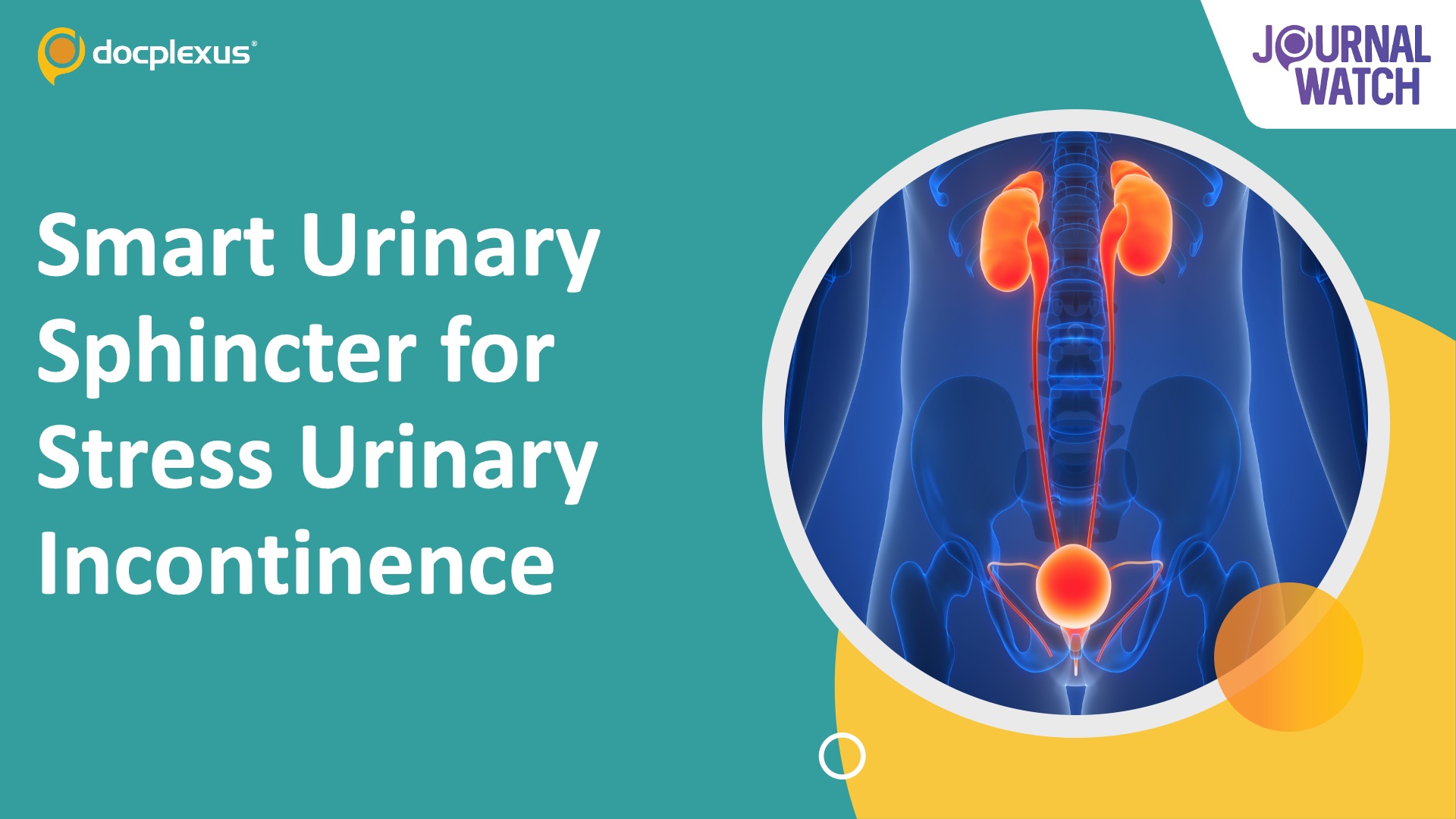 First-in-Human Electronic Urinary Sphincter Shows Promising Results in Men with Stress Urinary Incontinence