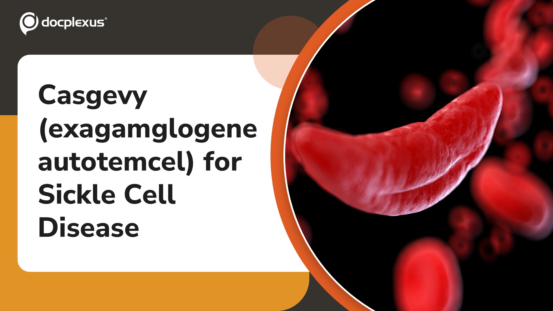 FDA ALERT: FDA Approves First Gene Therapy for Young Children with Sickle Cell Disease