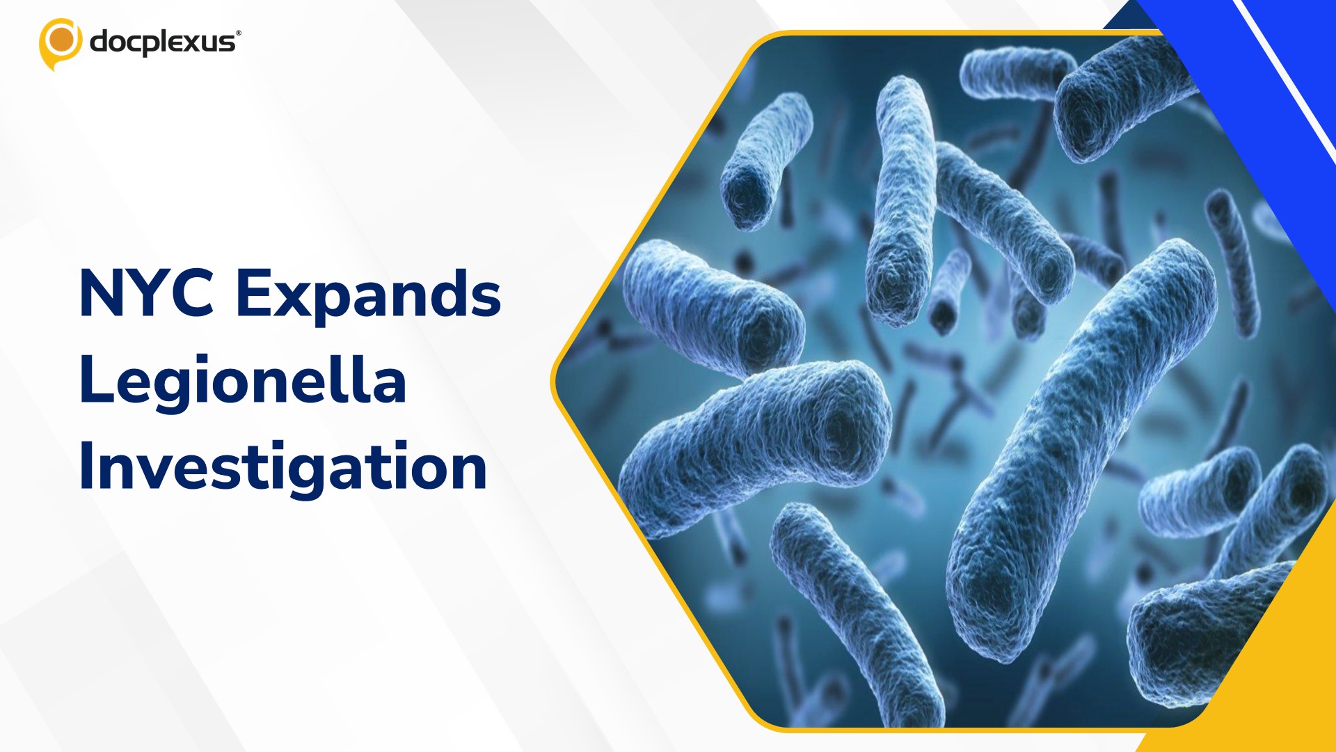 76 Upper East Side Buildings Test Positive for Legionella as NYC Investigation Expands