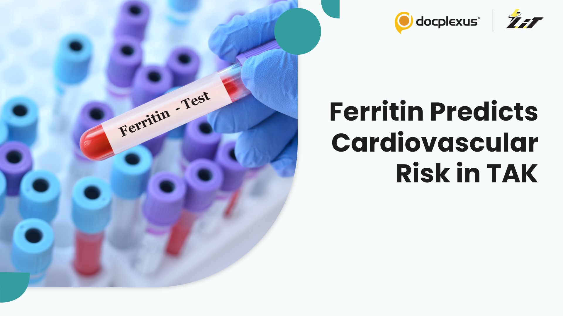 Serum Ferritin Identified as an Independent Predictor of Cardiovascular Events in Takayasu Arteritis