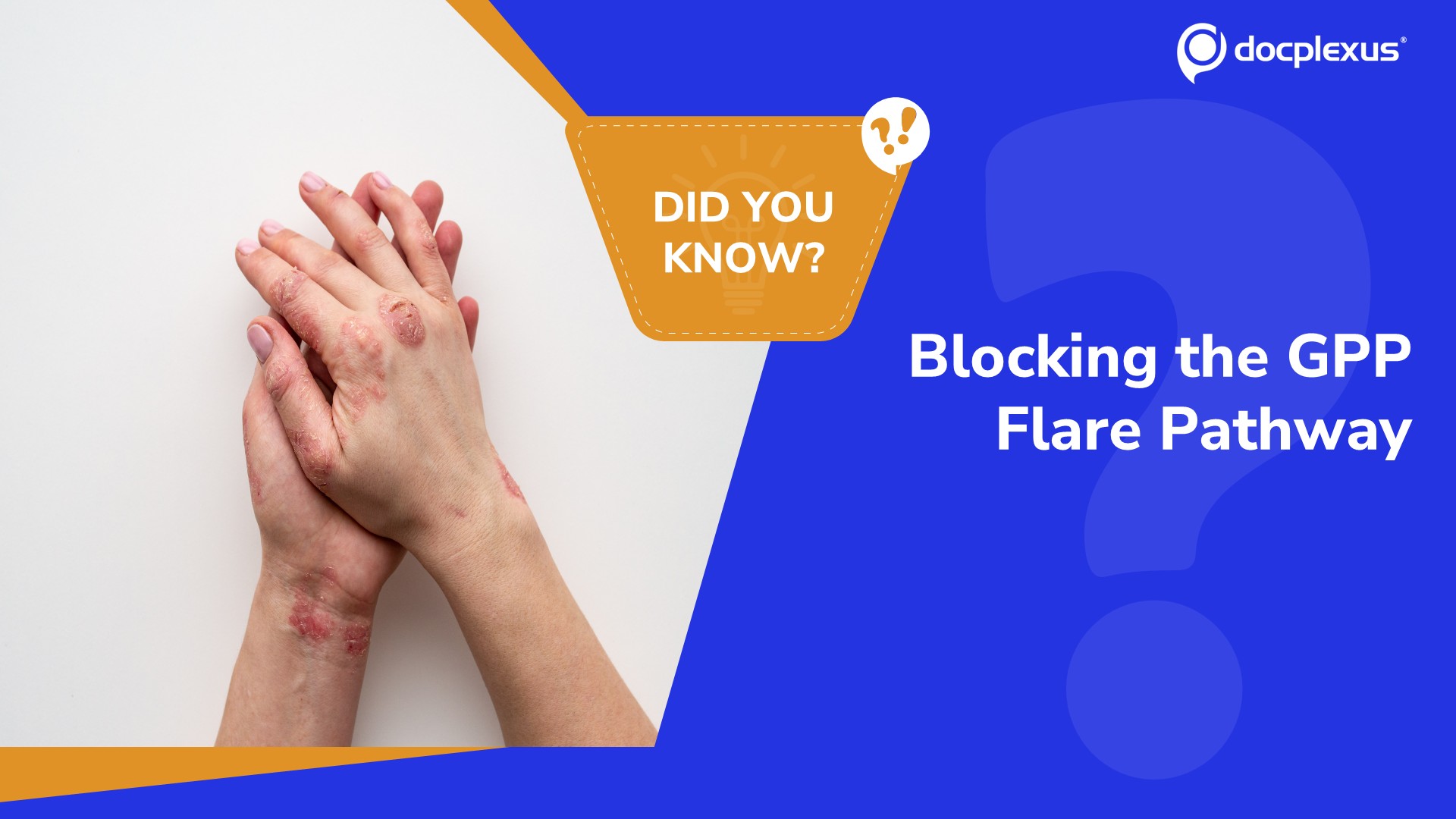 Which Targeted Therapy Is Approved for Generalized Pustular Psoriasis Flares?