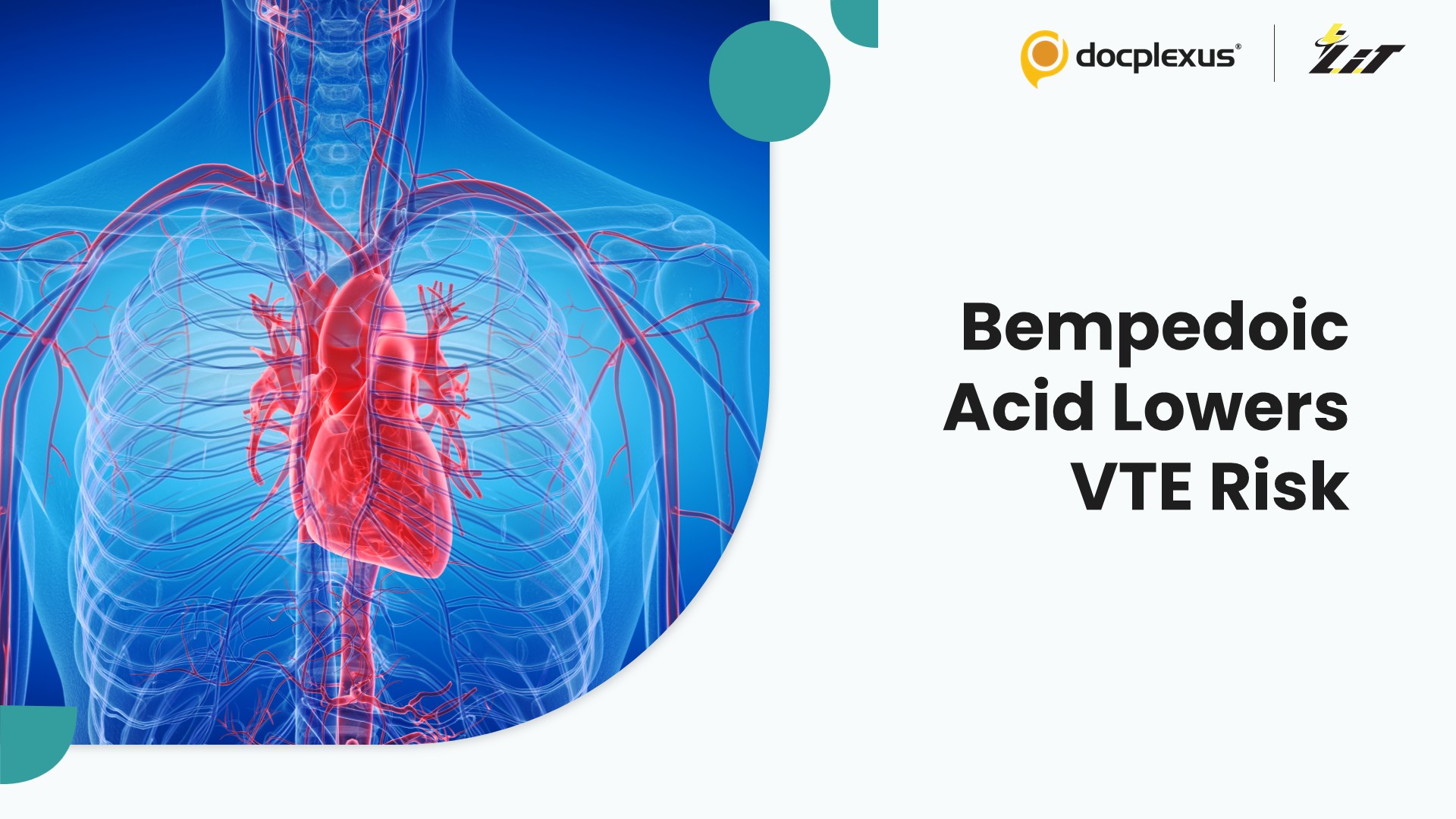 Bempedoic Acid Associated With Lower Venous Thromboembolism Risk in Statin-Intolerant Patients