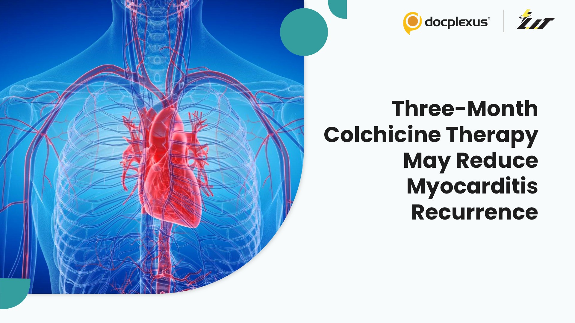 Prolonged Colchicine Therapy Linked to Lower Recurrence Risk in Young Adults With Acute Myocarditis