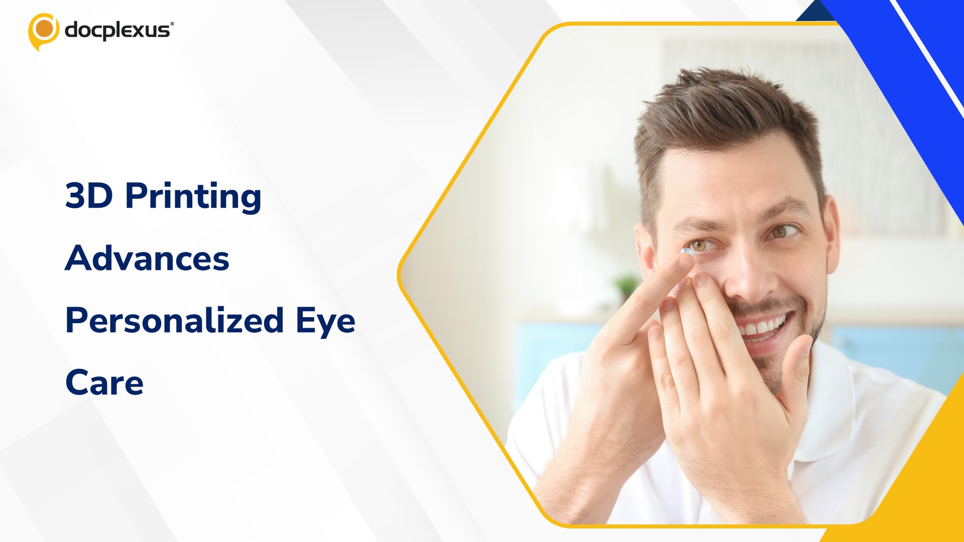 University of Waterloo Develops Patient-Specific 3D-Printed Contact Lenses
