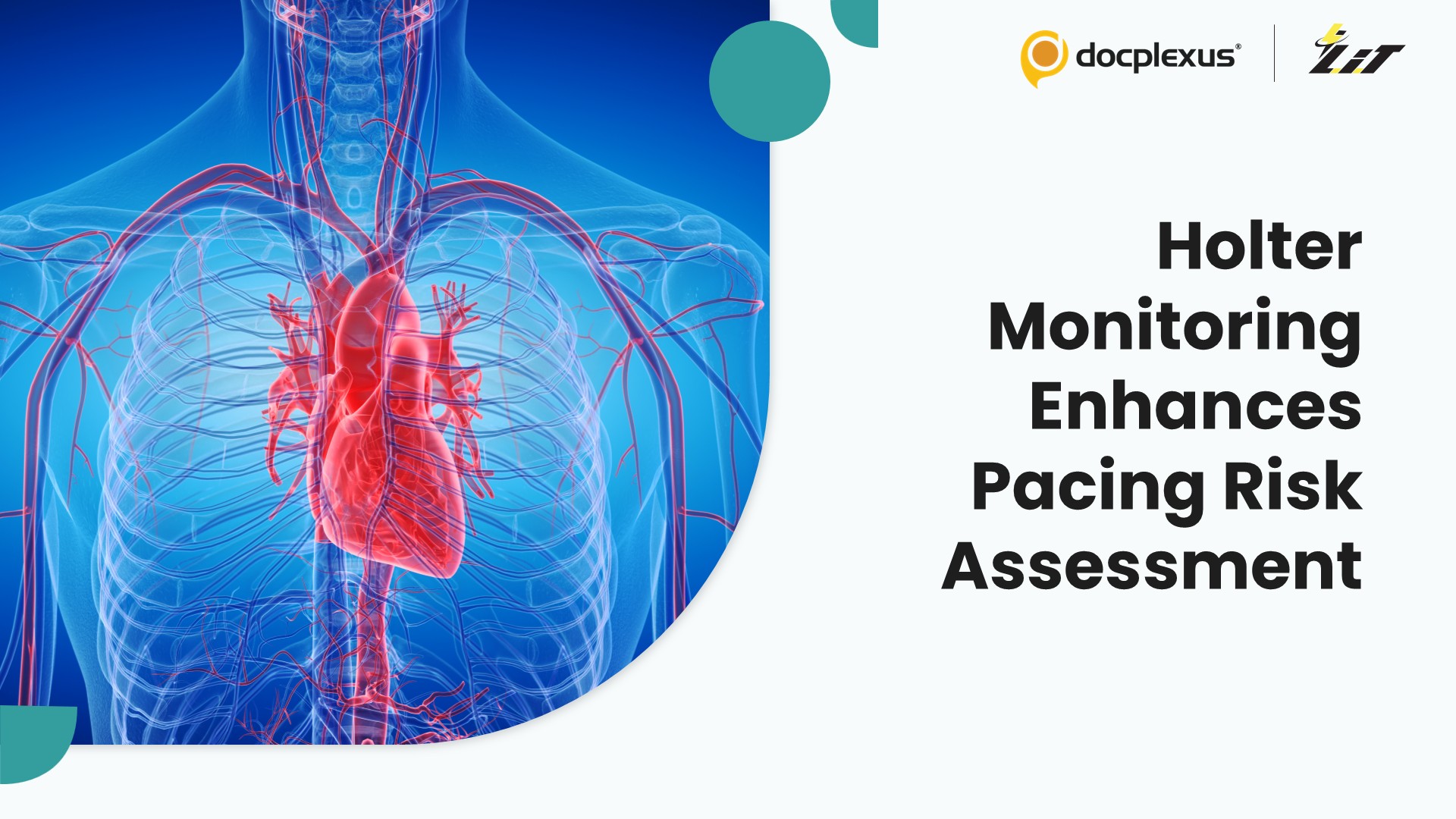 Combined ECG and Holter Monitoring Improve Pacing Decisions in Myotonic Dystrophy Type 1