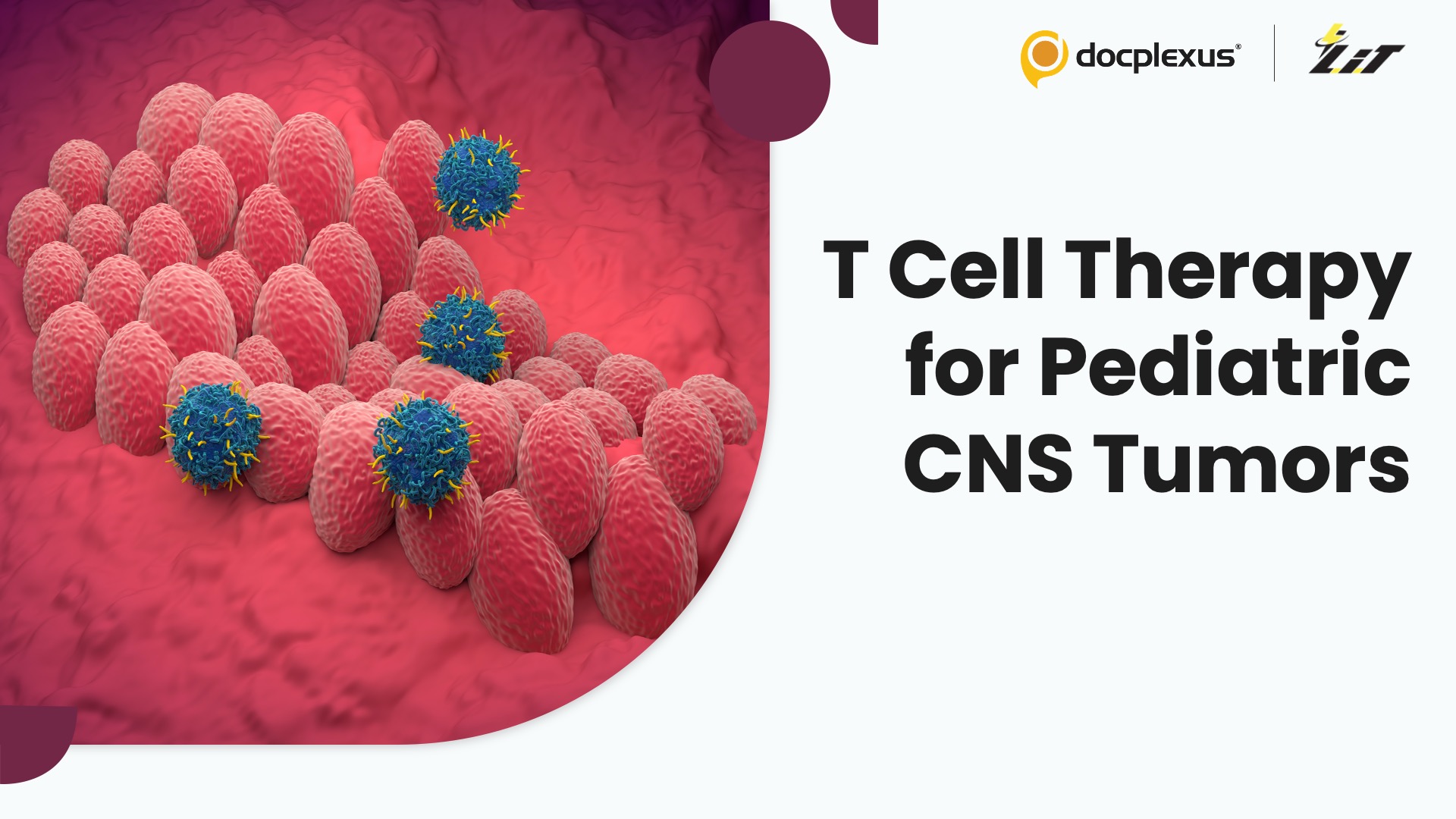 T Cell Therapy Shows Early Promise in Pediatric CNS Tumors