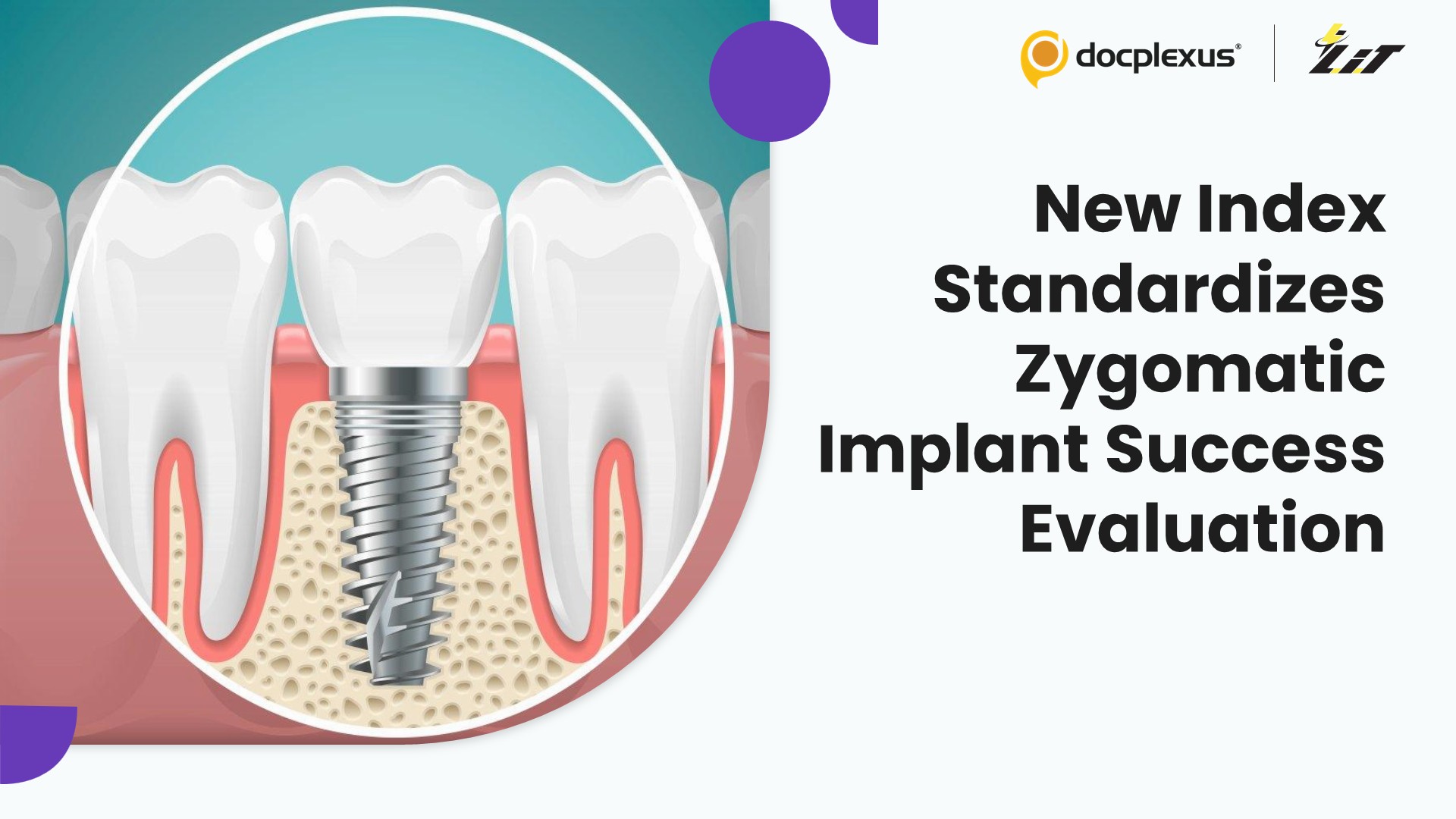 Zygomatic Implant Success Index Shows Reliability for Comprehensive Implant Outcome Assessment