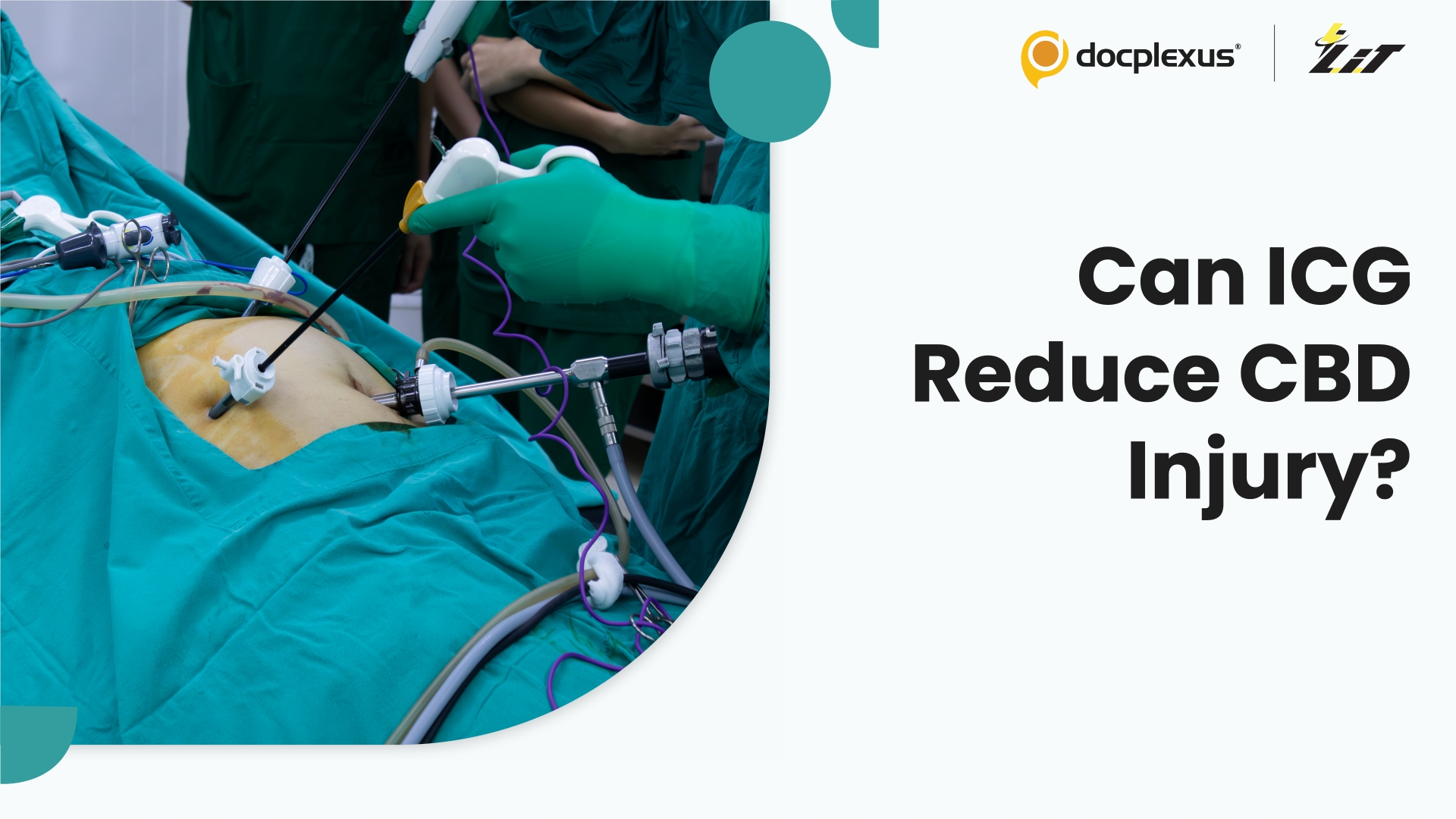 ICG Fluorescence Cholangiography Associated With Improved Outcomes in Laparoscopic Cholecystectomy
