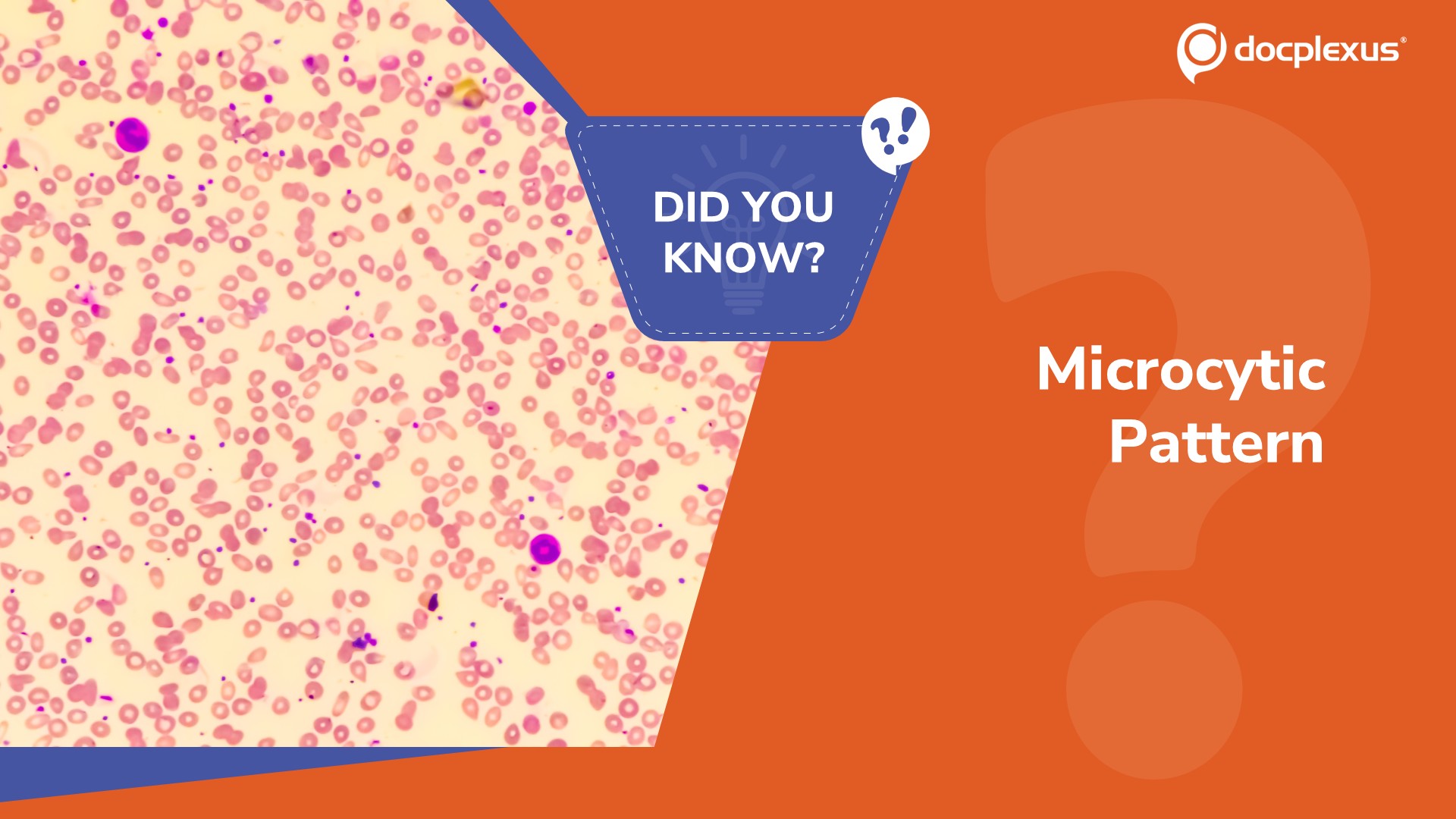 Which Lab Pattern Points to Iron Deficiency Anemia?