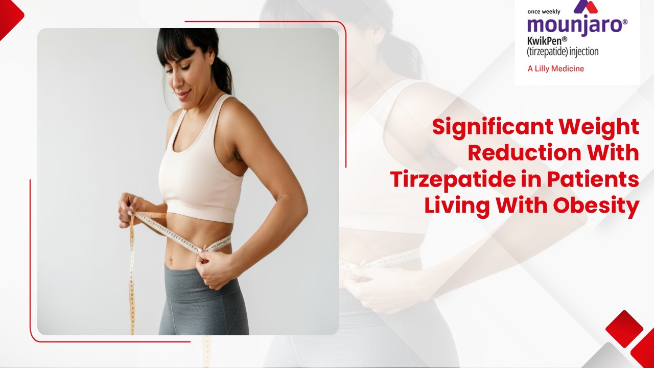 SURMOUNT-1: Efficacy and Safety of Tirzepatide for Weight Management