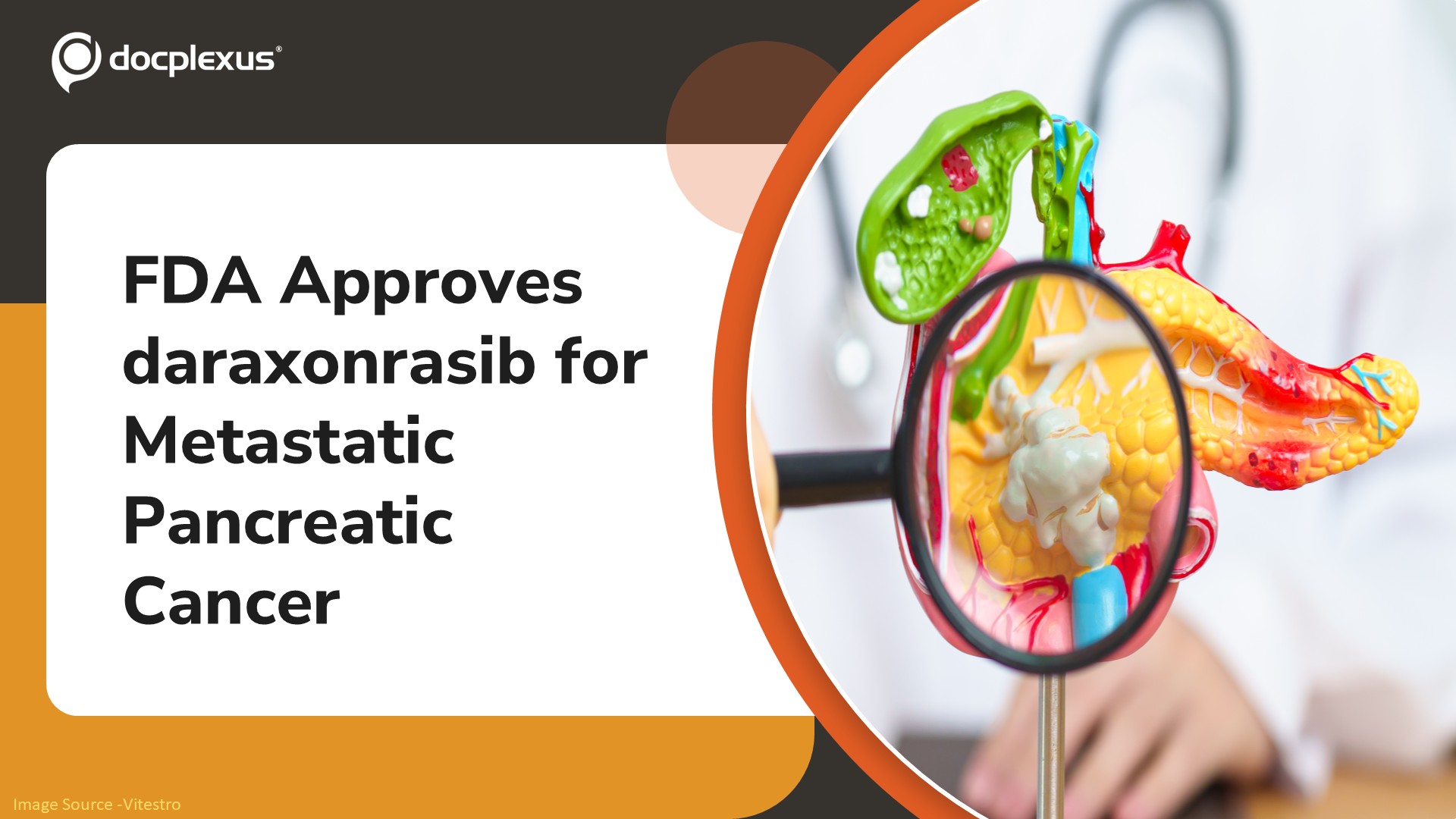 FDA Approves daraxonrasib (Rasonque) for Metastatic Pancreatic Cancer