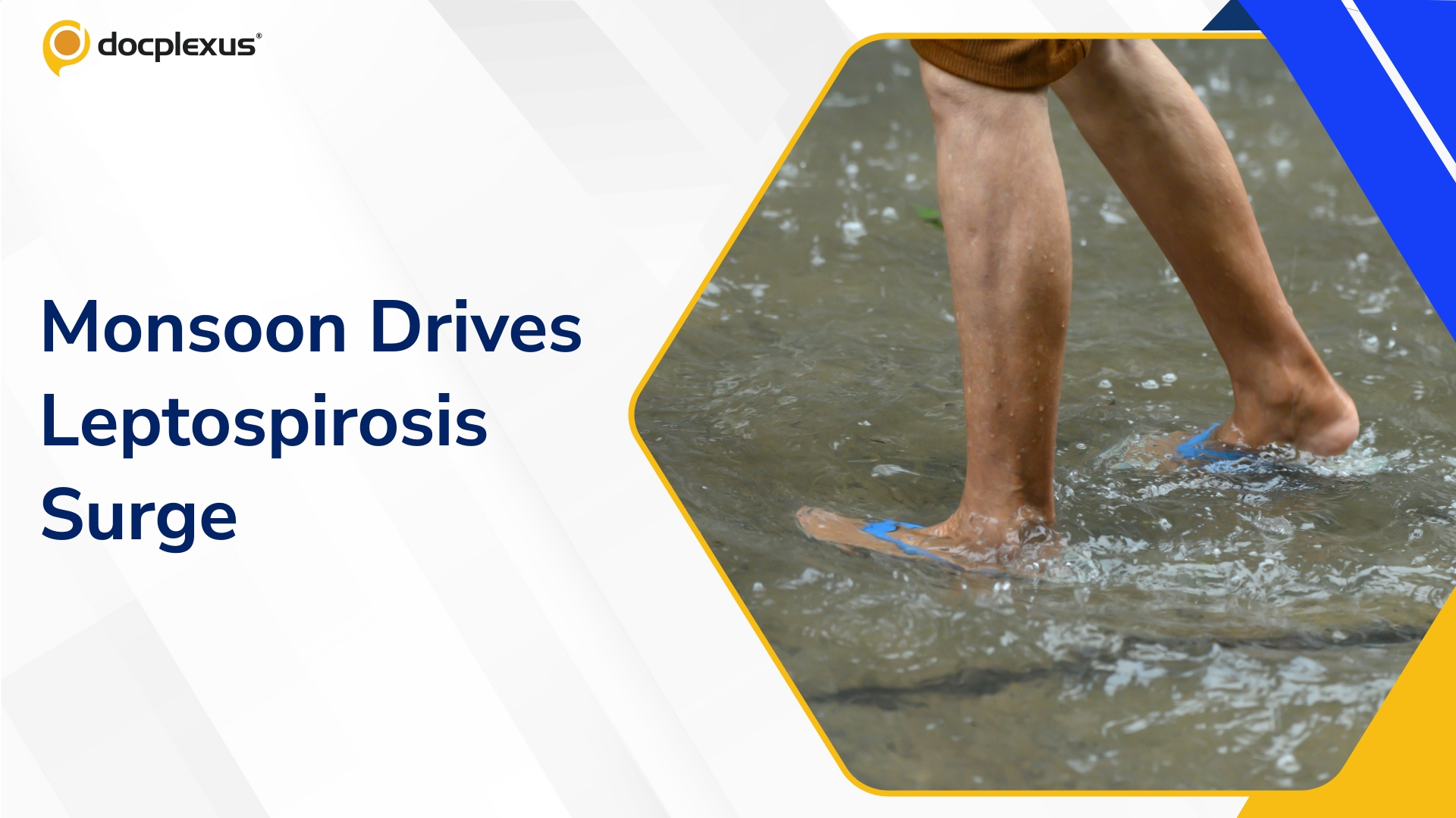 Leptospirosis Cases Surge Nearly 125-Fold in Telangana