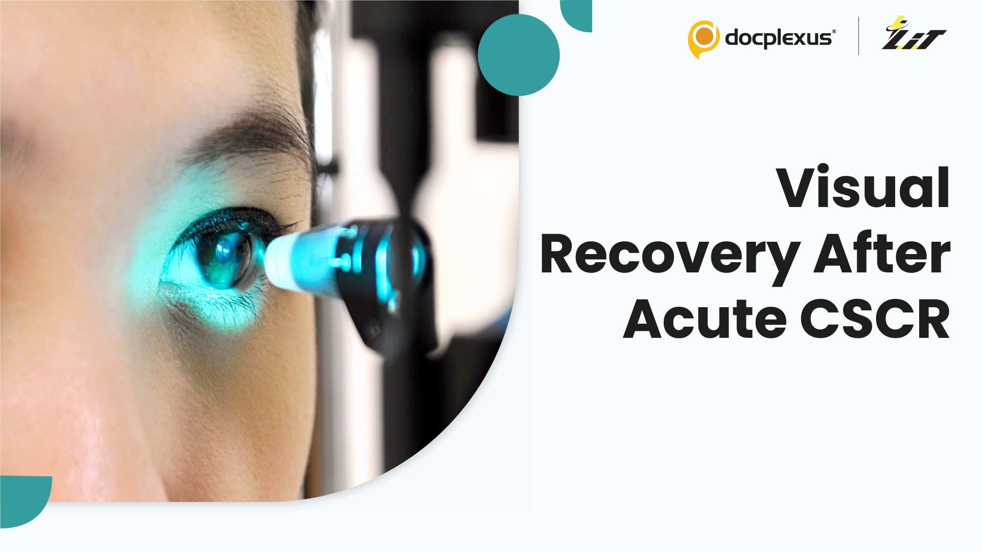 Factors Influencing Visual Recovery in Acute Central Serous Chorioretinopathy