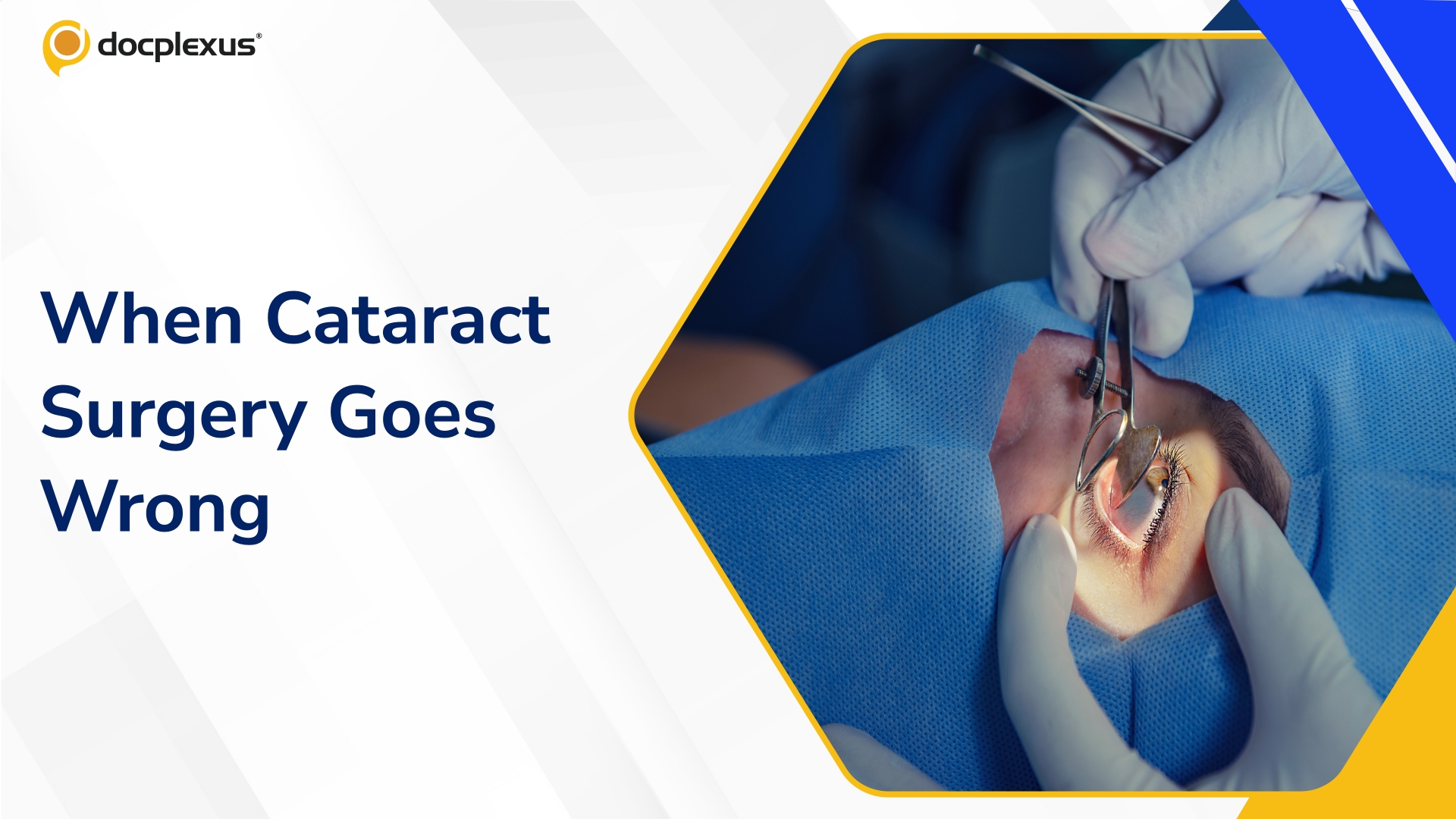 Cataract Surgery Complications Trigger Rs 78 Lakh Compensation Recommendation