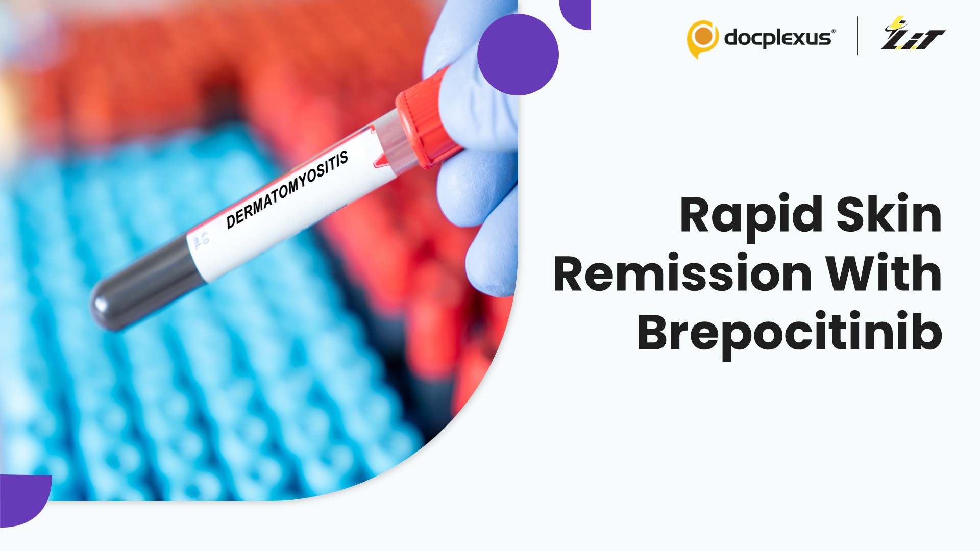 Brepocitinib Improves Skin Outcomes in Dermatomyositis