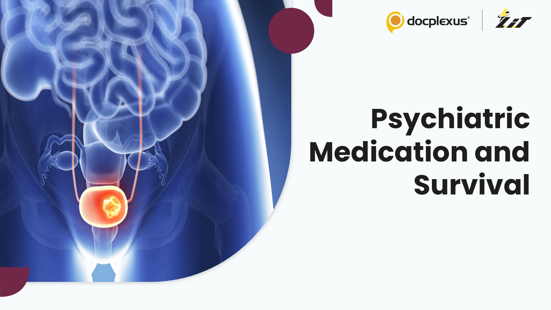 Postoperative Psychiatric Medication Use Linked to Survival After Bladder Cancer Surgery