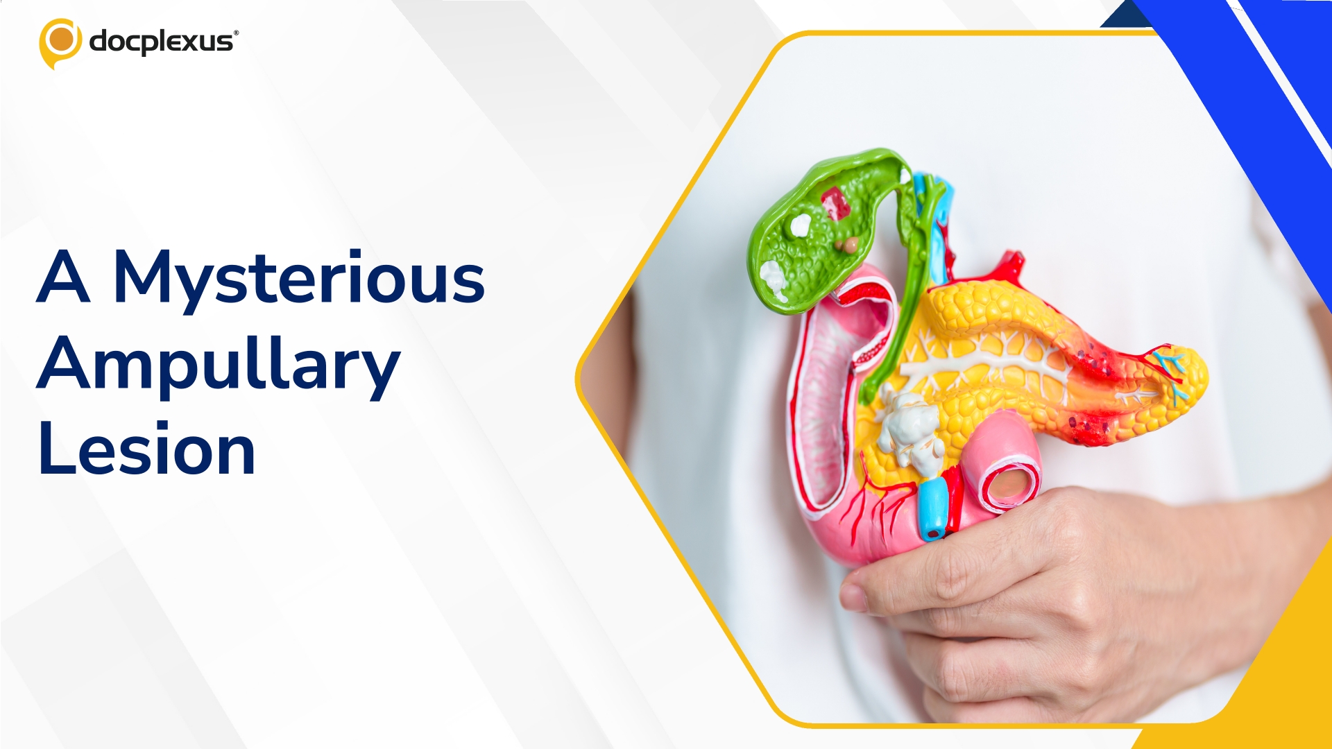 Jaundice After Colon Cancer: What Is Causing the Ampullary Lesion?