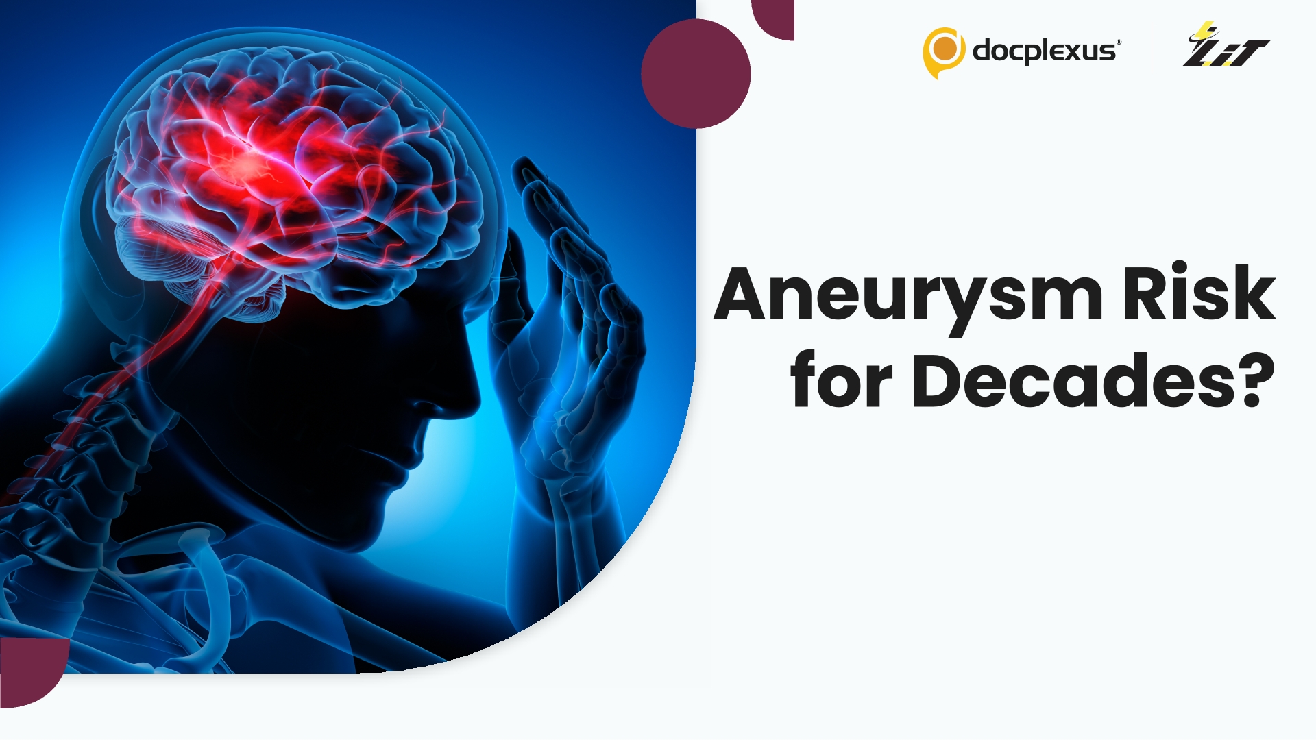 De Novo Aneurysm Risk After Aneurysmal Subarachnoid Hemorrhage