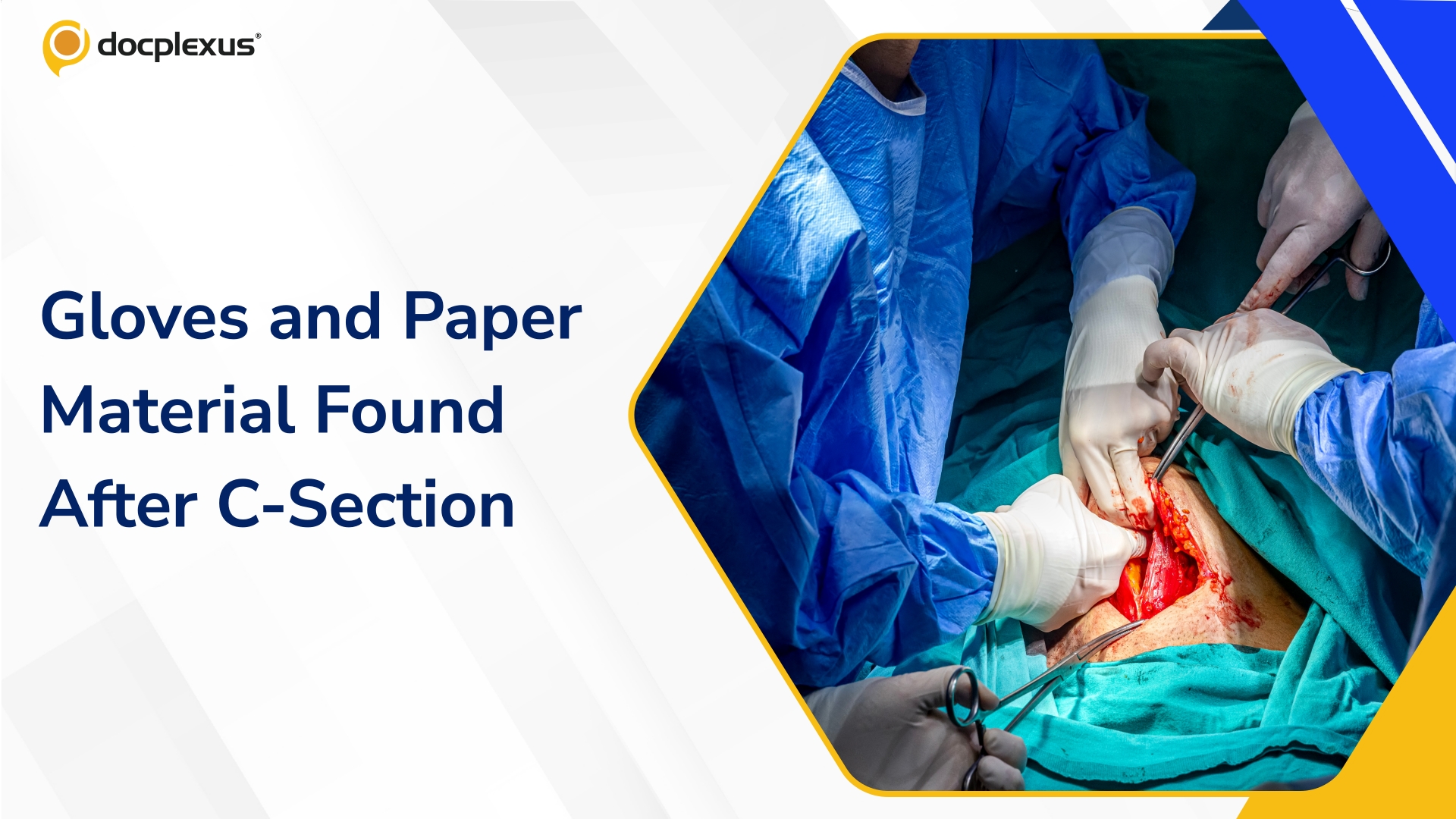 Surgical Gloves and Paper Material Allegedly Found in Patient’s Abdomen After C-Section