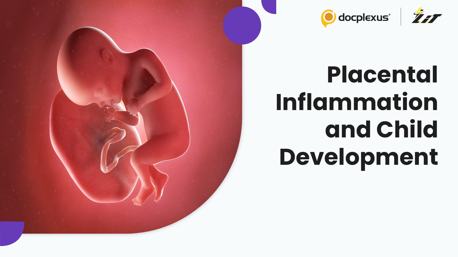 Chronic Placental Inflammation Linked to Early Neurodevelopmental Risk