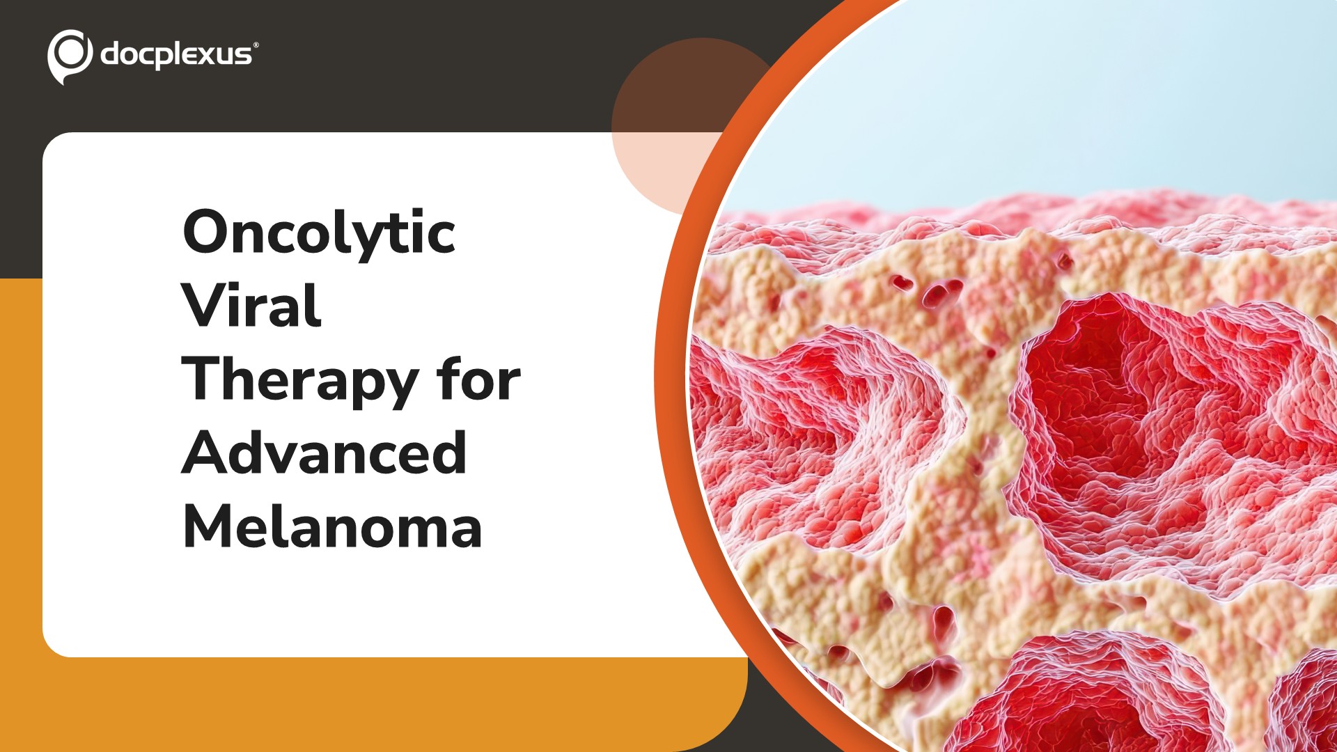 US FDA Approves Vusolimogene Oderparepvec-wtpg for Advanced Melanoma