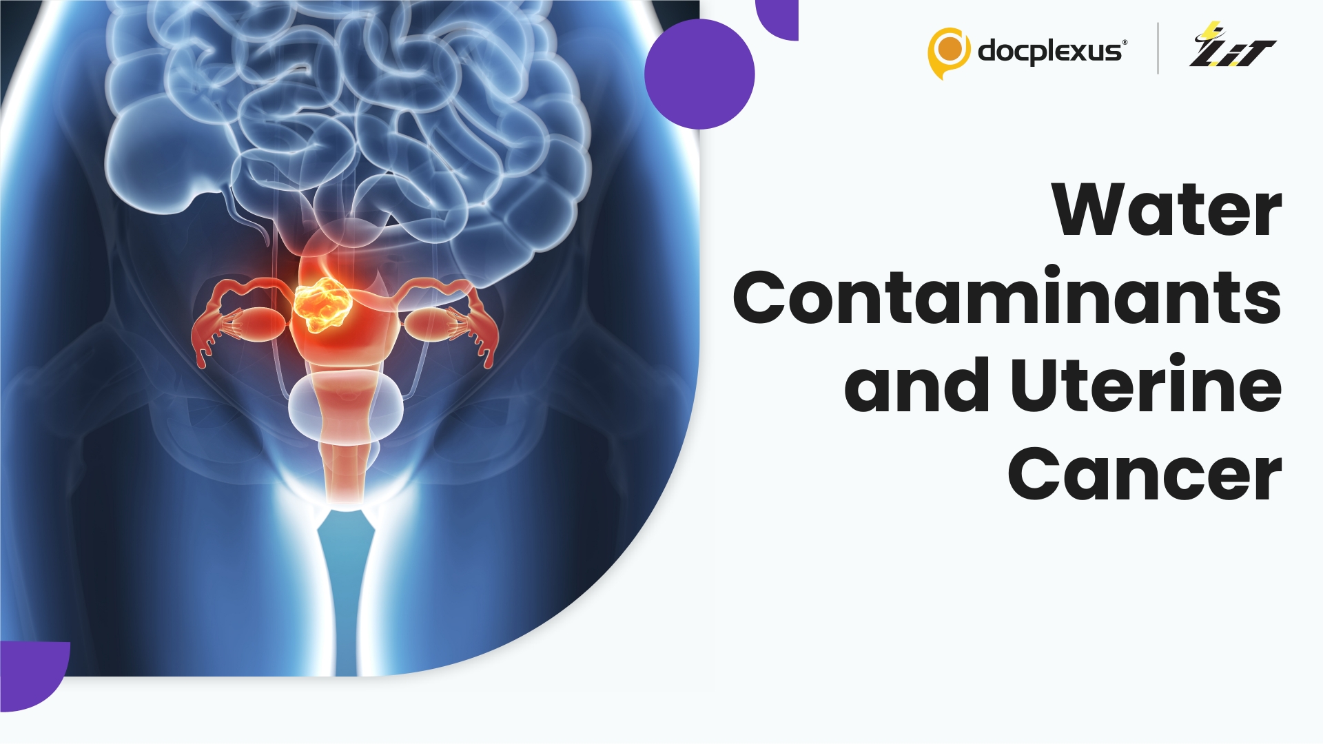 Drinking Water Contaminants Linked to Higher Uterine Cancer Risk