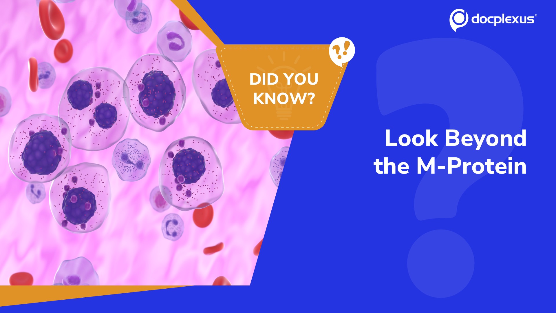 Which Finding Confirms Active Multiple Myeloma?