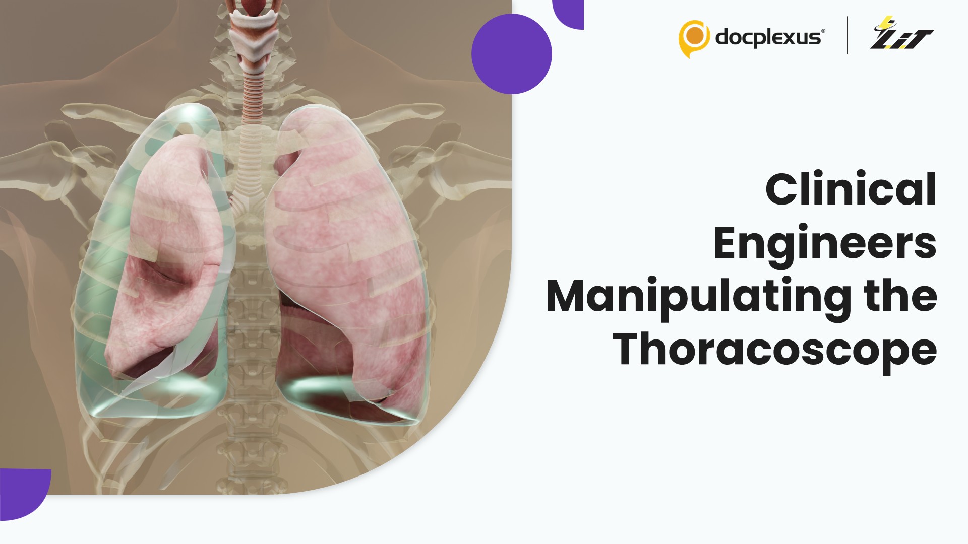 Thoracoscopic Surgery With Clinical Engineer Scope Manipulation Is Feasible for Spontaneous Pneumothorax