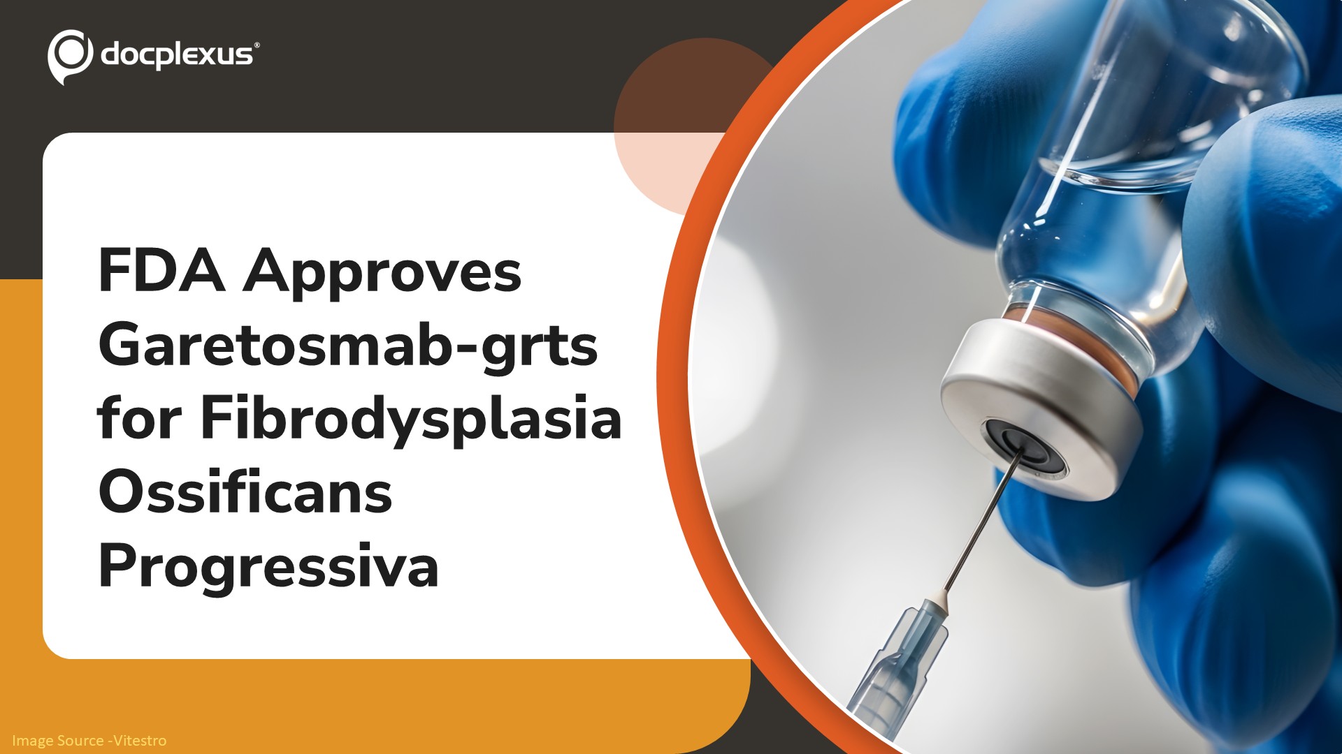 FDA Approves Garetosmab-grts (Pasatru) for Fibrodysplasia Ossificans Progressiva