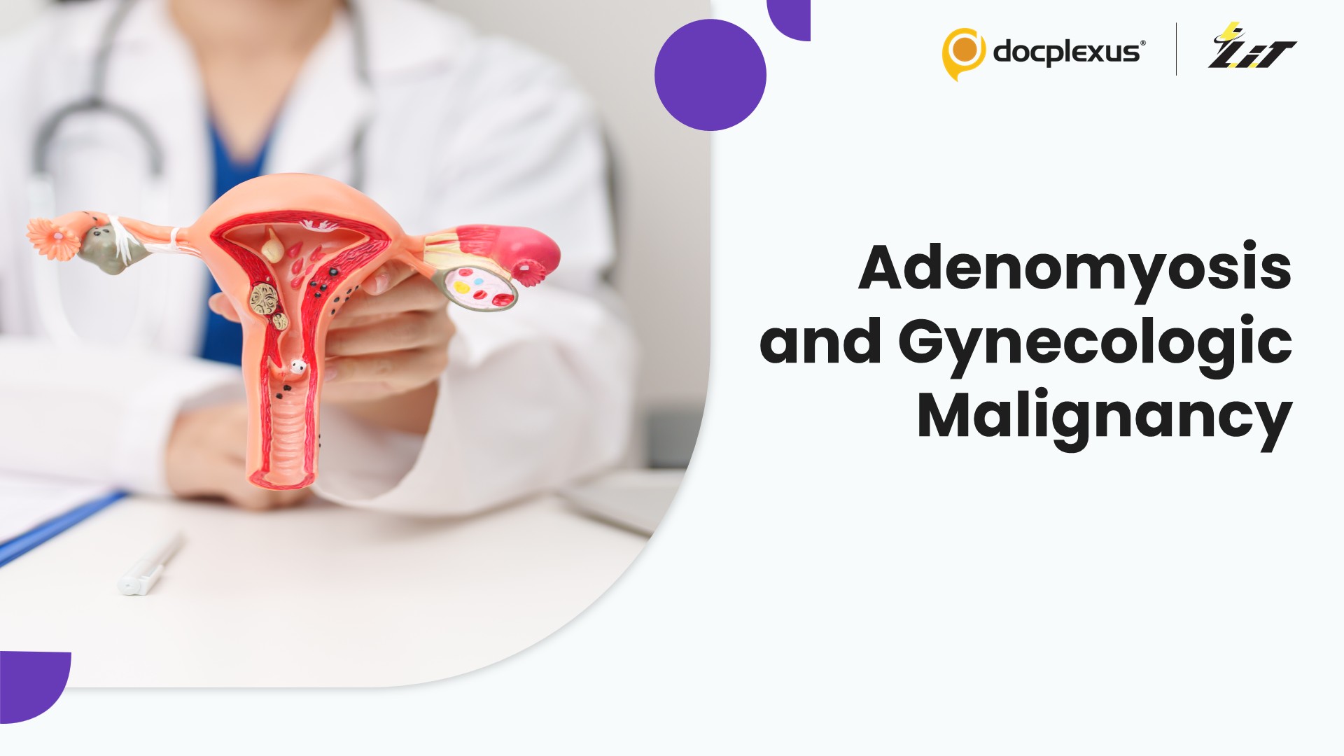 Adenomyosis Without Coexisting Leiomyoma or Endometriosis Linked to Gynecologic Malignancy