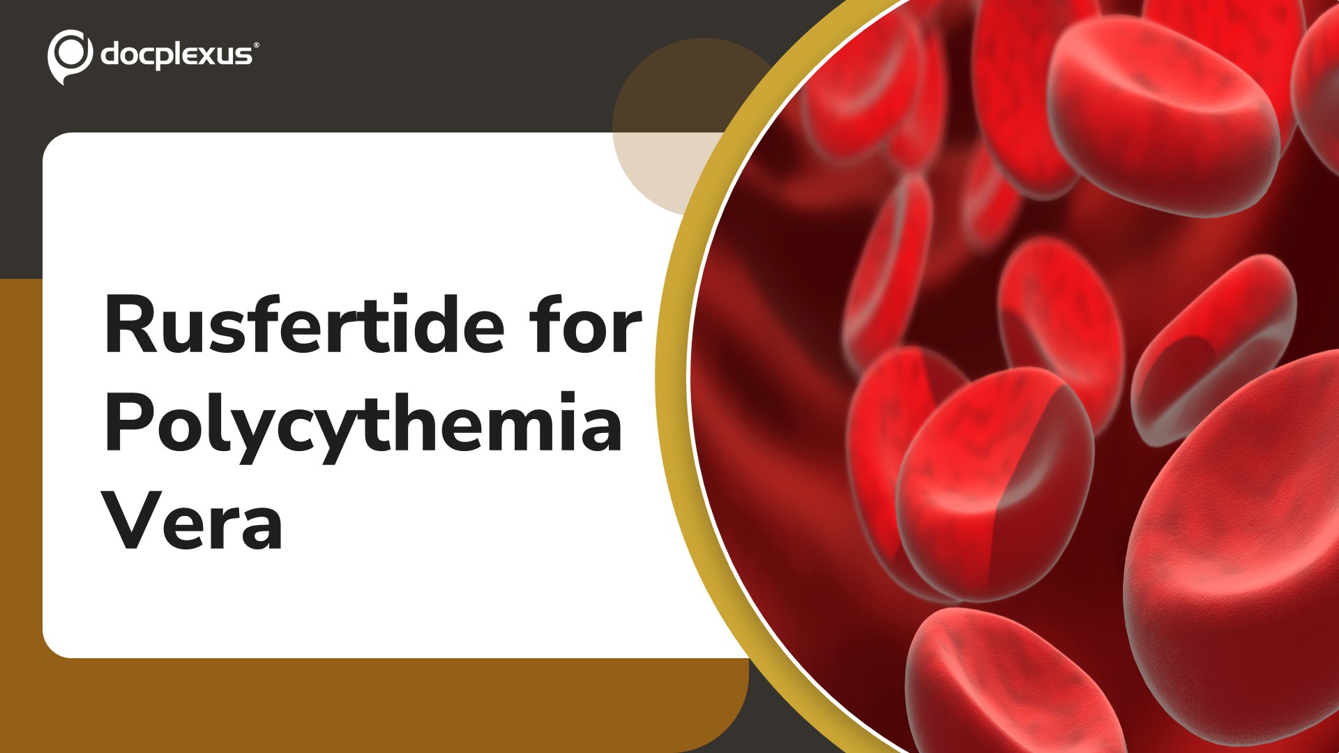 FDA Approves Rusfertide (Mimeylo) for Polycythemia Vera